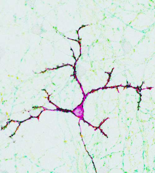 Nervenzelle mit synaptischen Kontakten. (© Foto: Biozentrum Universität Basel) 