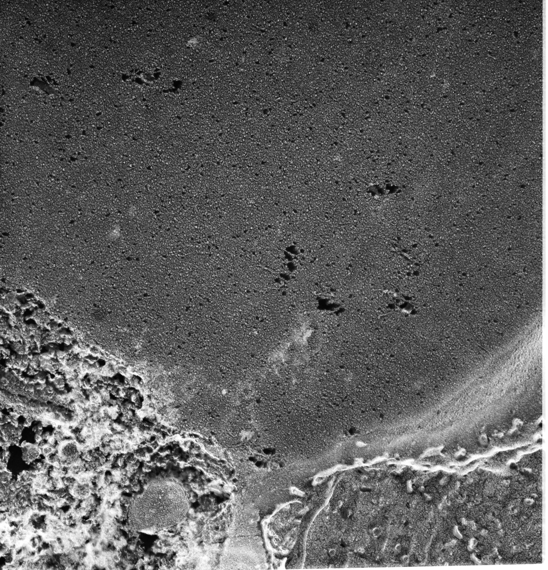 Paramecium multimicronucleatum (Contractile vacuolar membrane) - CIL:13128