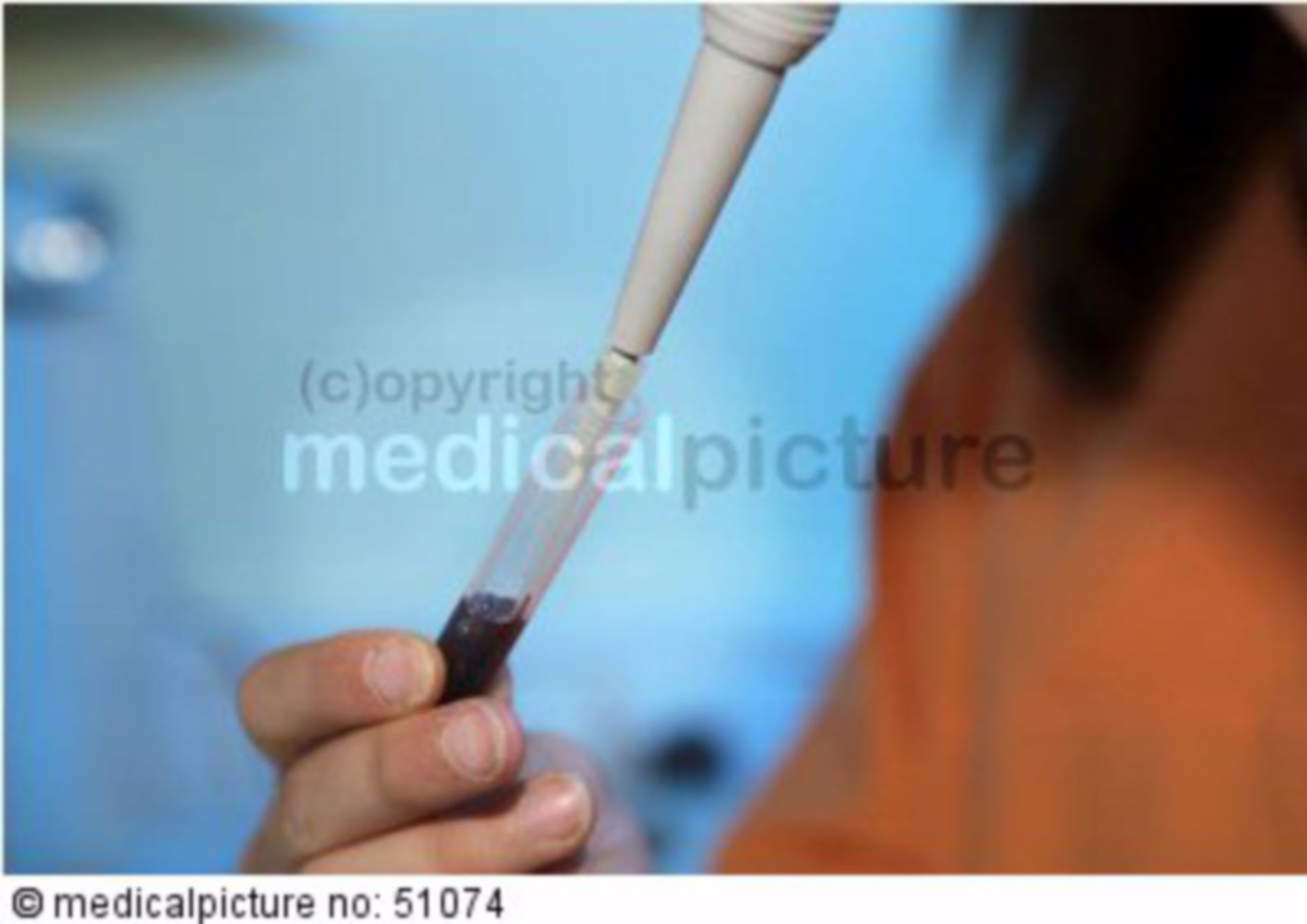  Laborassistentin mit Pipette und Blut 
