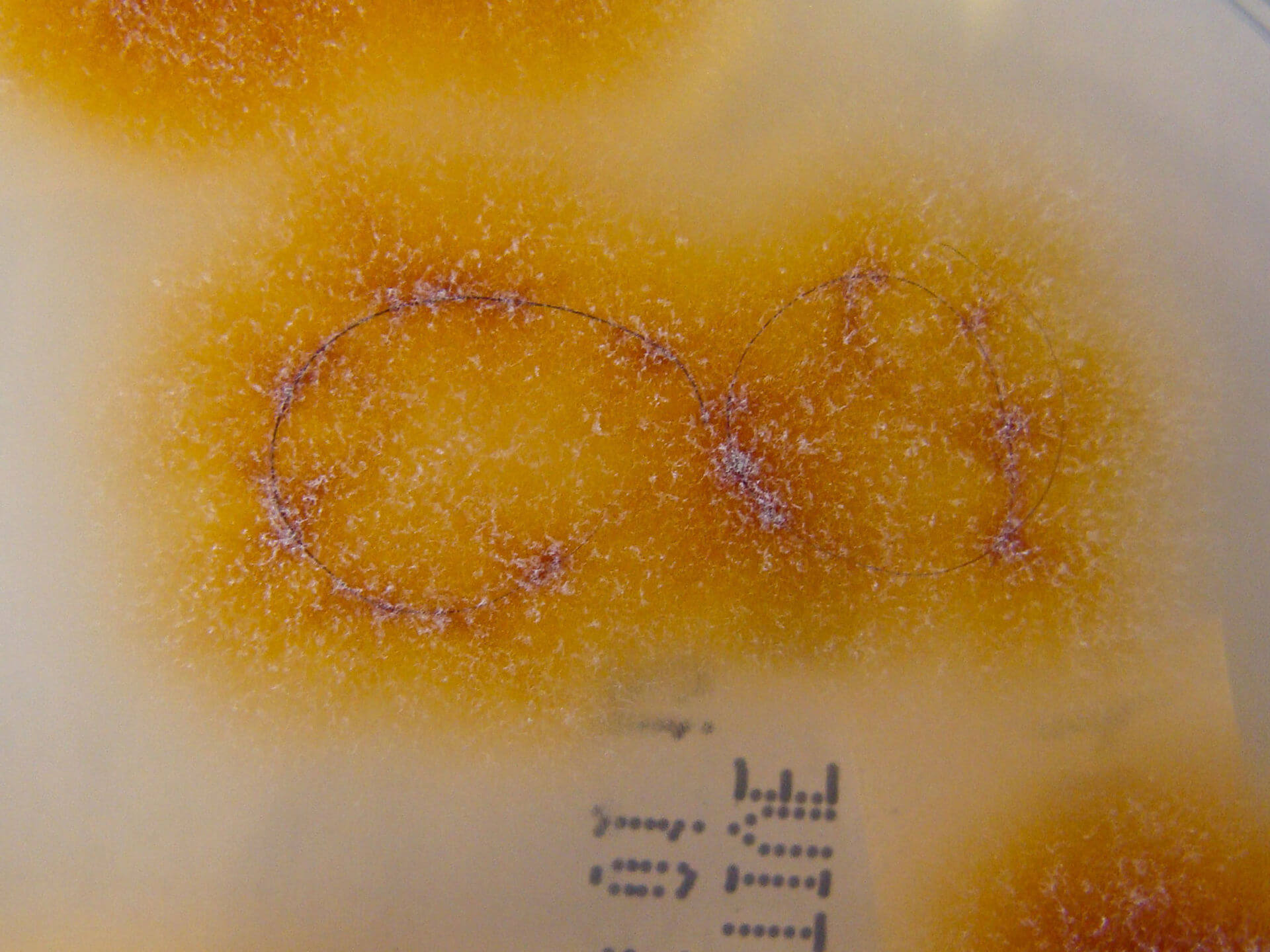 Trichophyton tonsurans