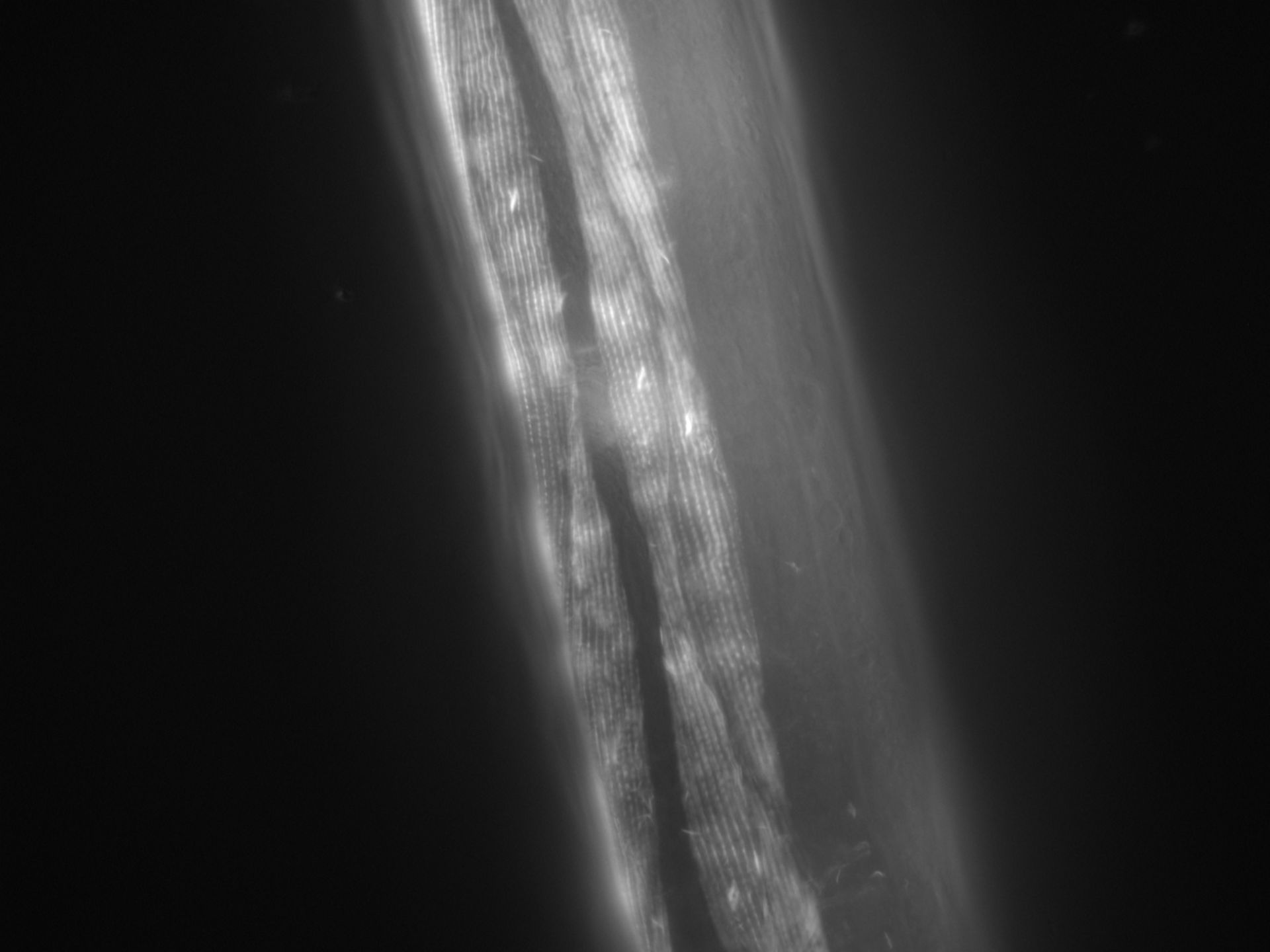 Caenorhabditis elegans (Actin filament) - CIL:1011