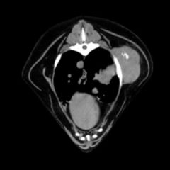 Lungenemphysem (Radiologie) - DocCheck Flexikon
