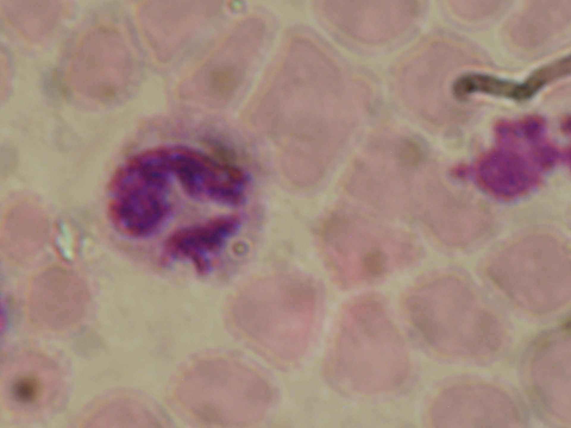 Plasmodium ovale schizonti