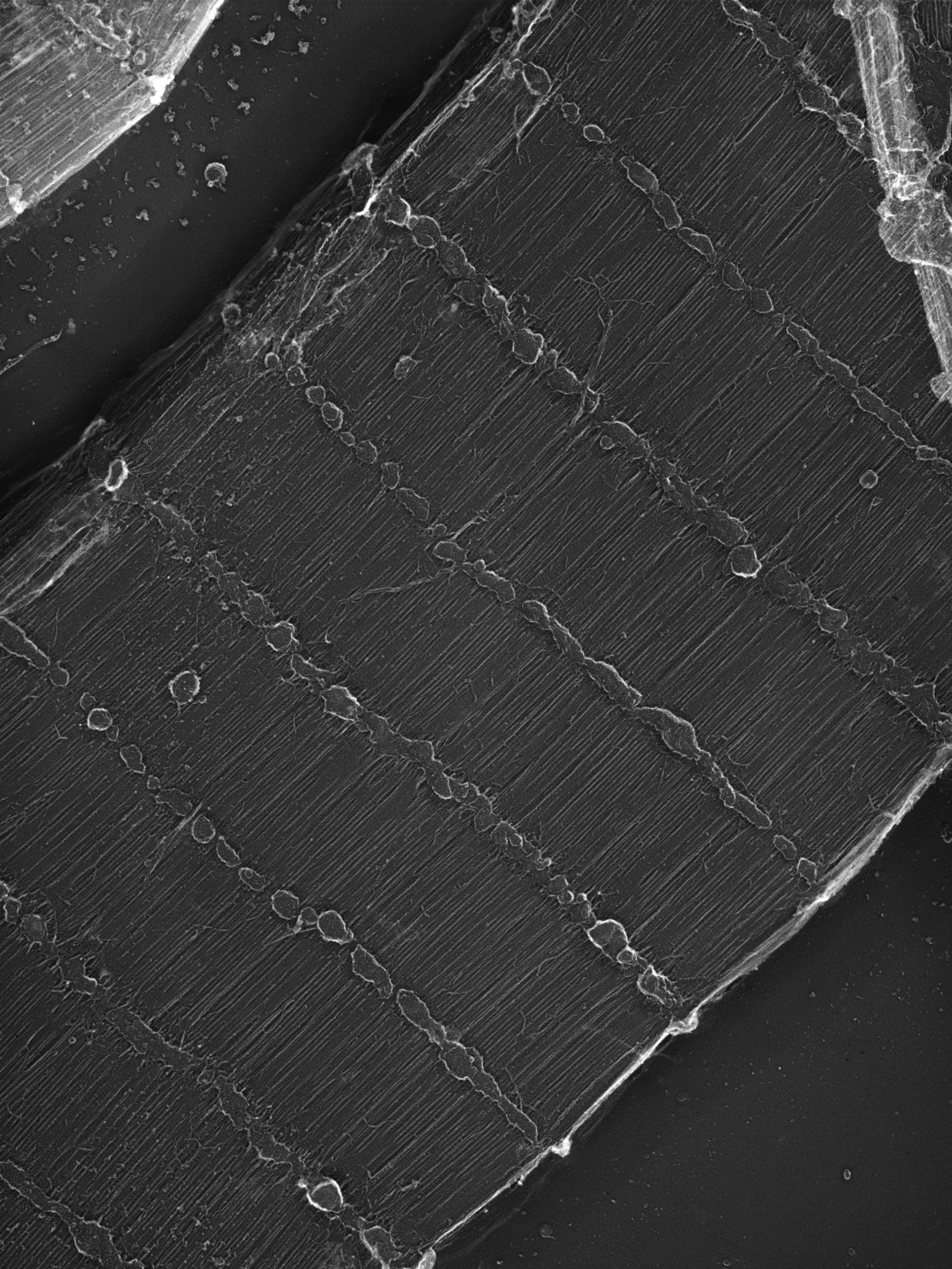 Damselfly (Sarcoplasmic reticulum) - CIL:36099