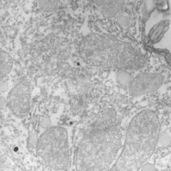 Polysom DocCheck Flexikon