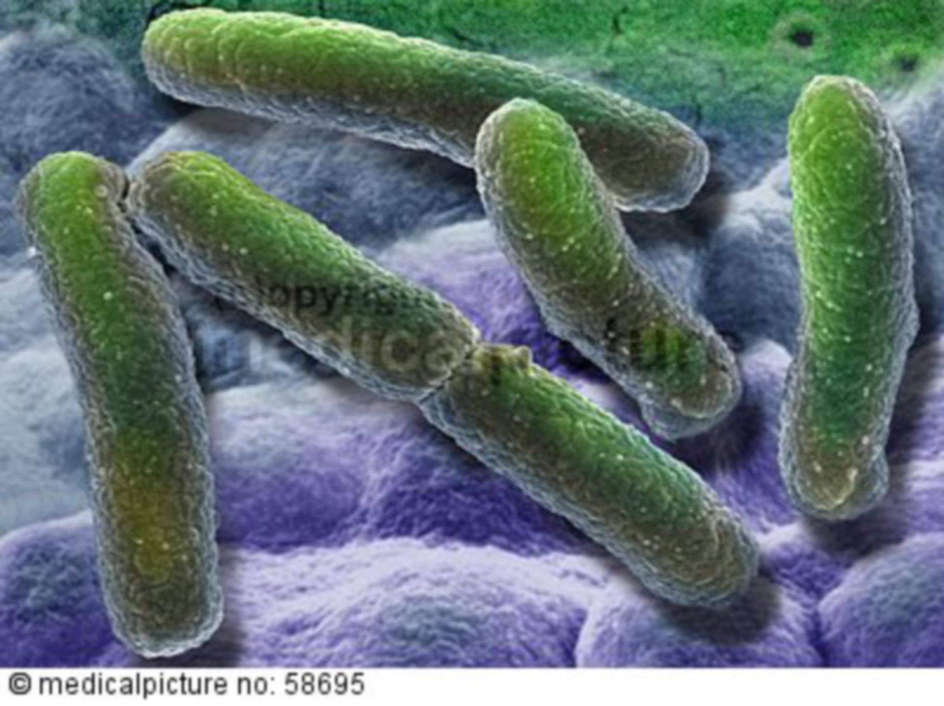  NDM 1-Bakterium 
