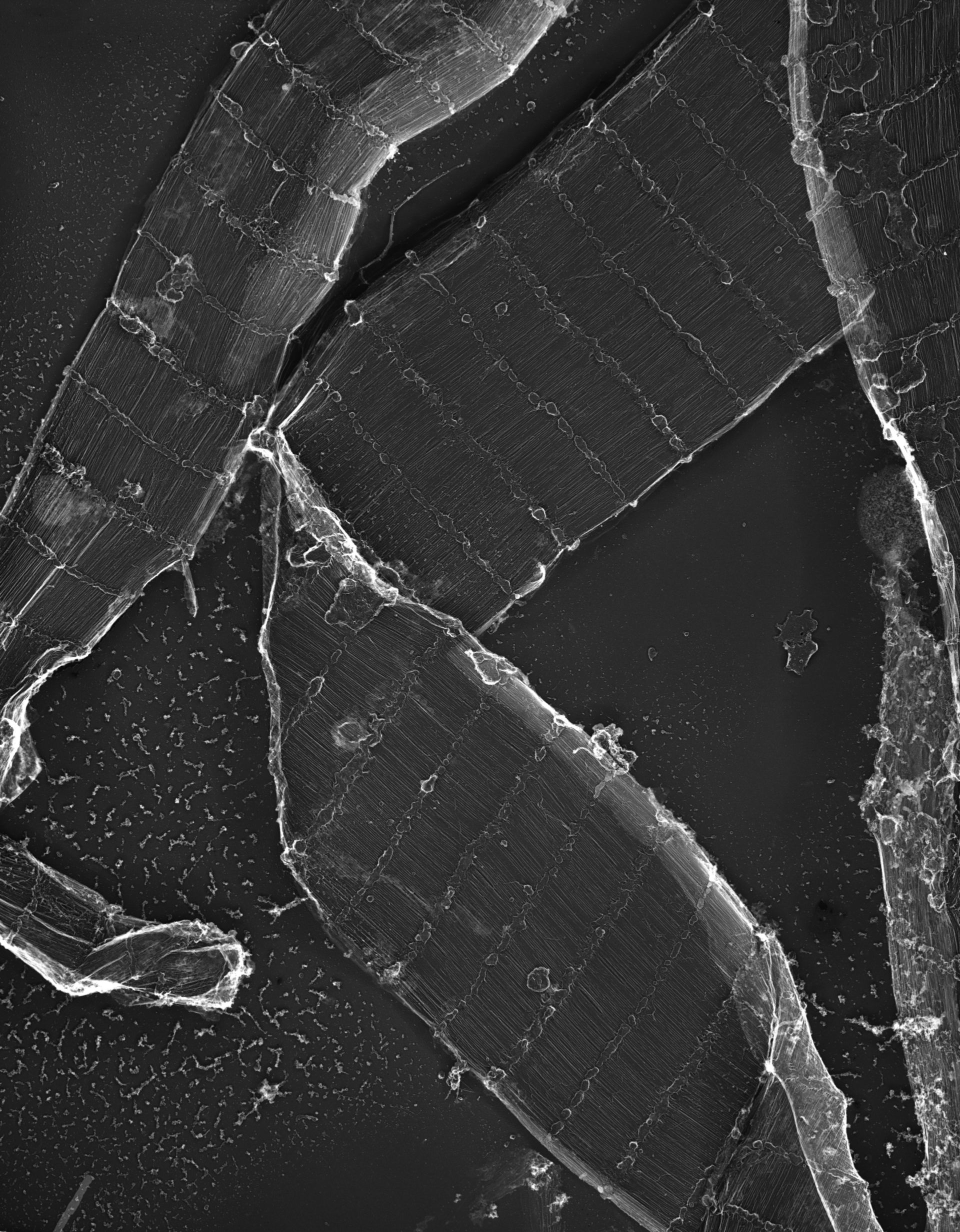 Damselfly (Sarcoplasmic reticulum) - CIL:36101