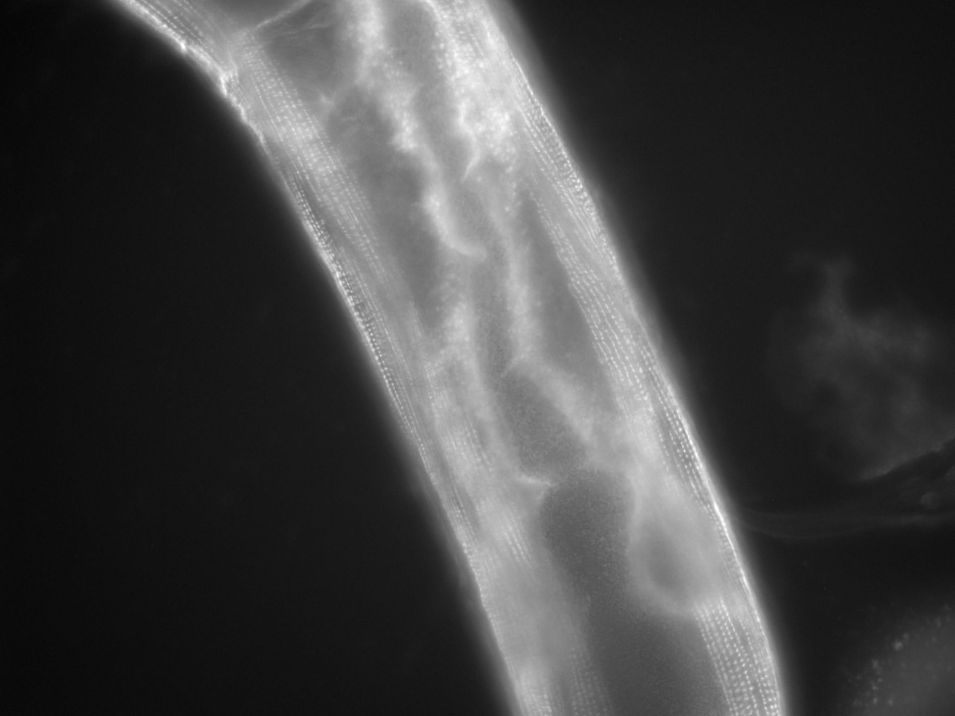 Caenorhabditis elegans (Actin filament) - CIL:1119