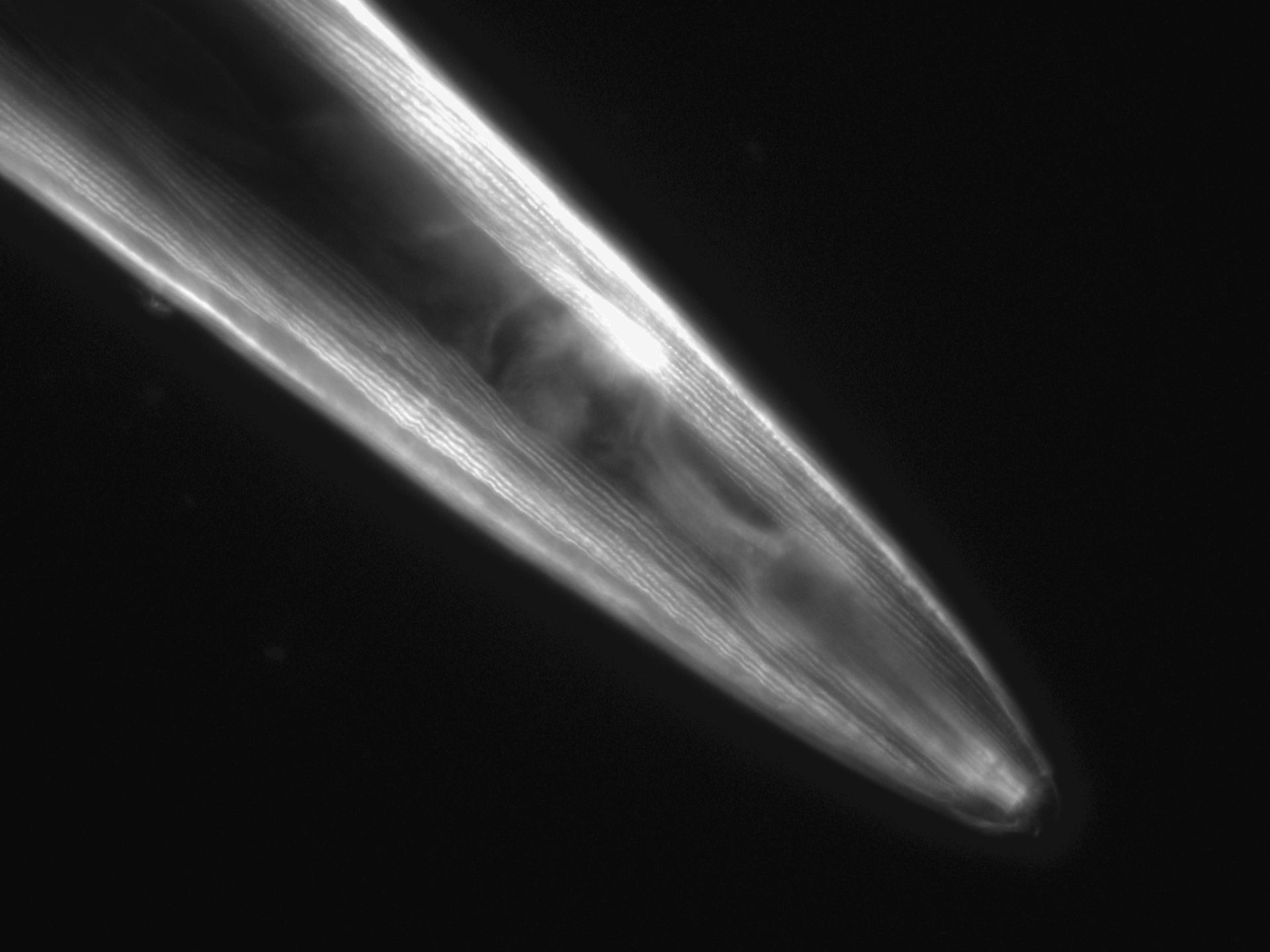 Caenorhabditis elegans (Actin filament) - CIL:1080