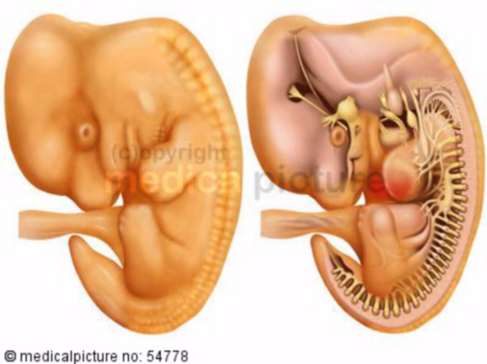  Embryo 8 bis 10 mm 
