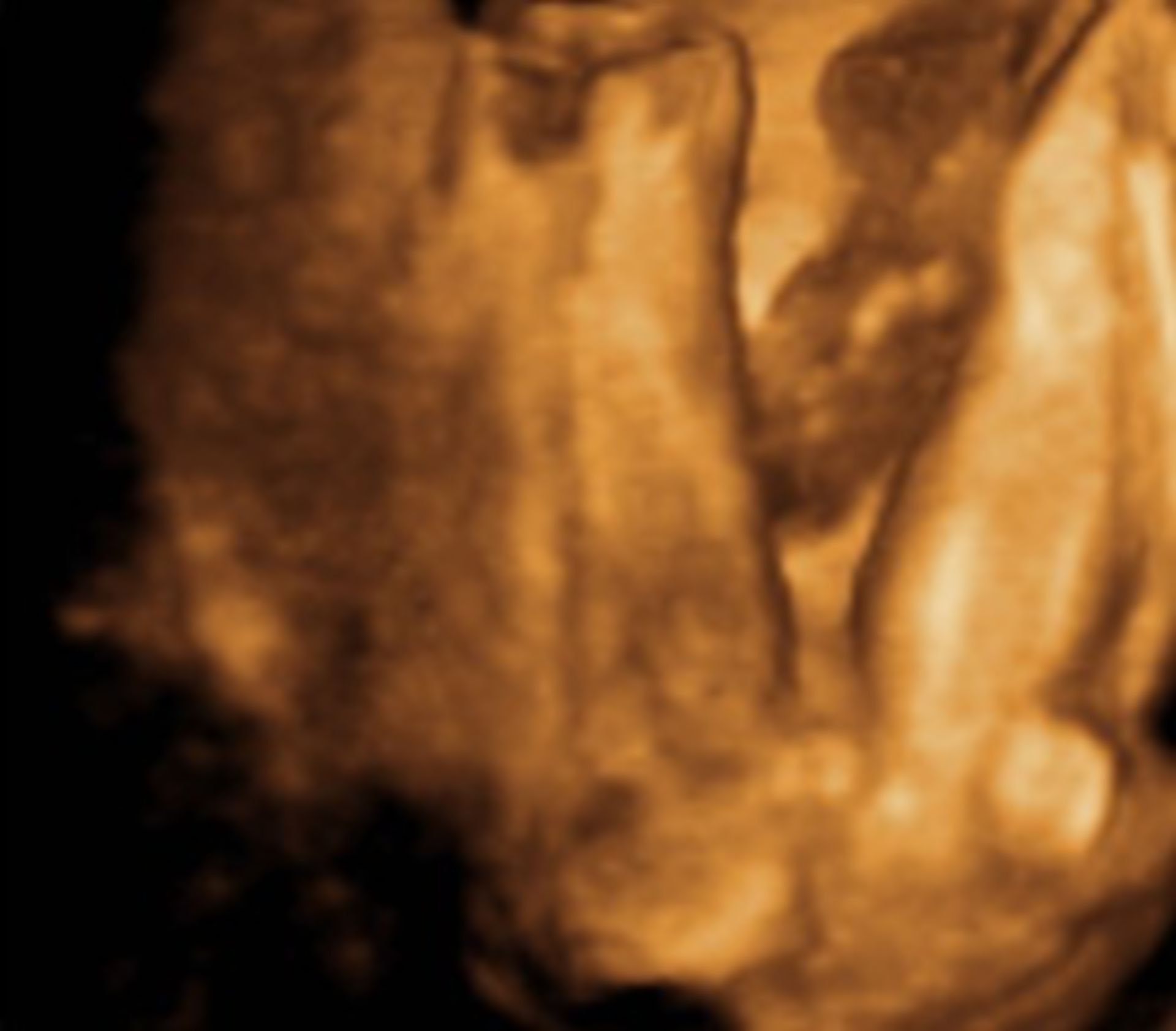 3D-ultrasound, 22 weeks pregnant