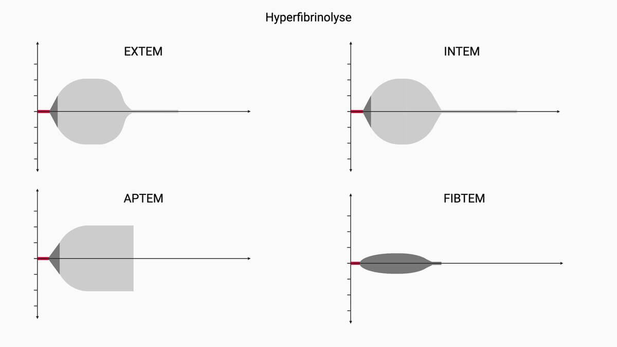 Rotationsthrombelastometrie (ROTEM®)