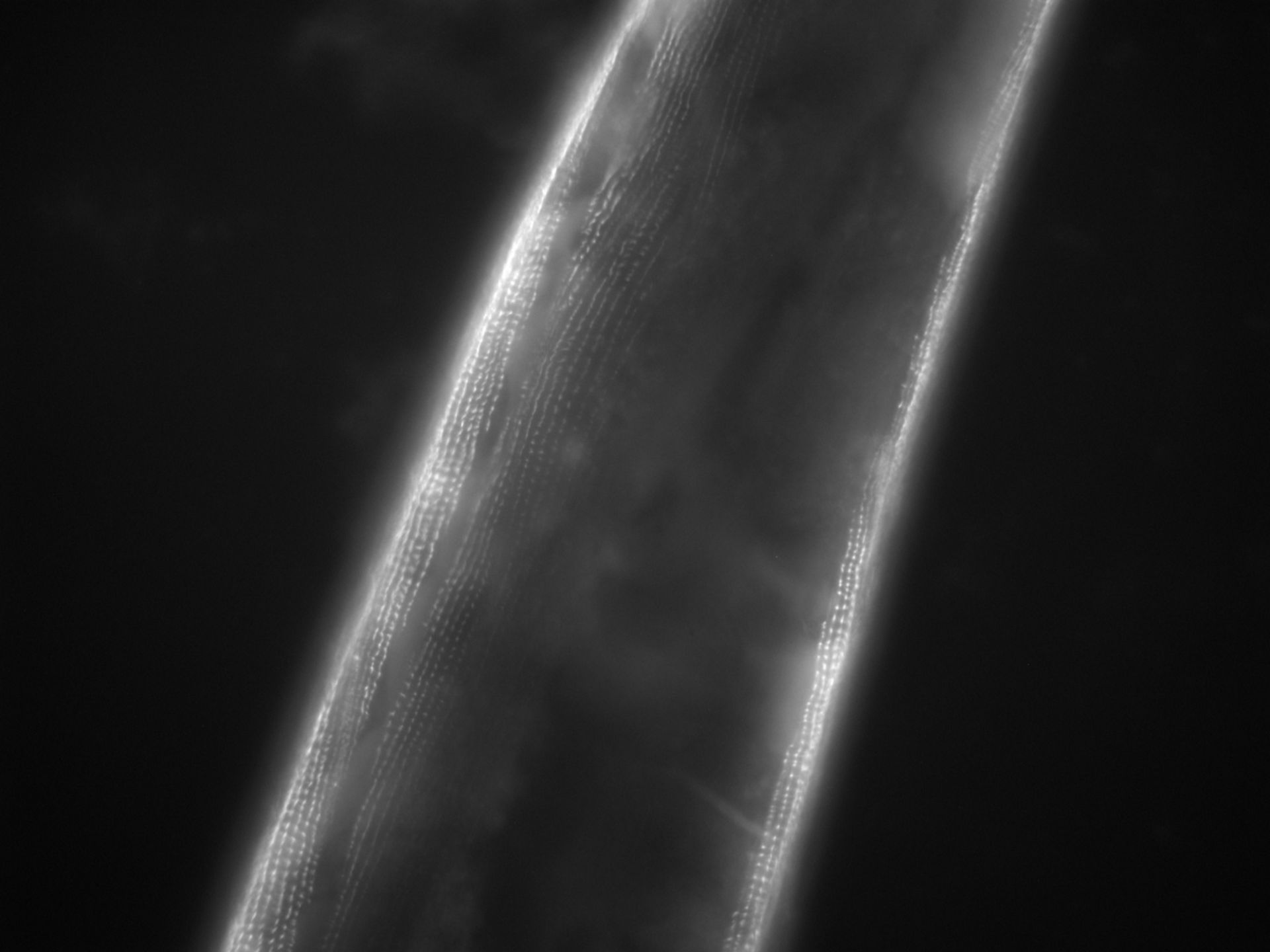 Caenorhabditis elegans (Actin filament) - CIL:1111