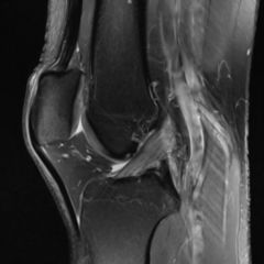 Kniegelenk - DocCheck Flexikon