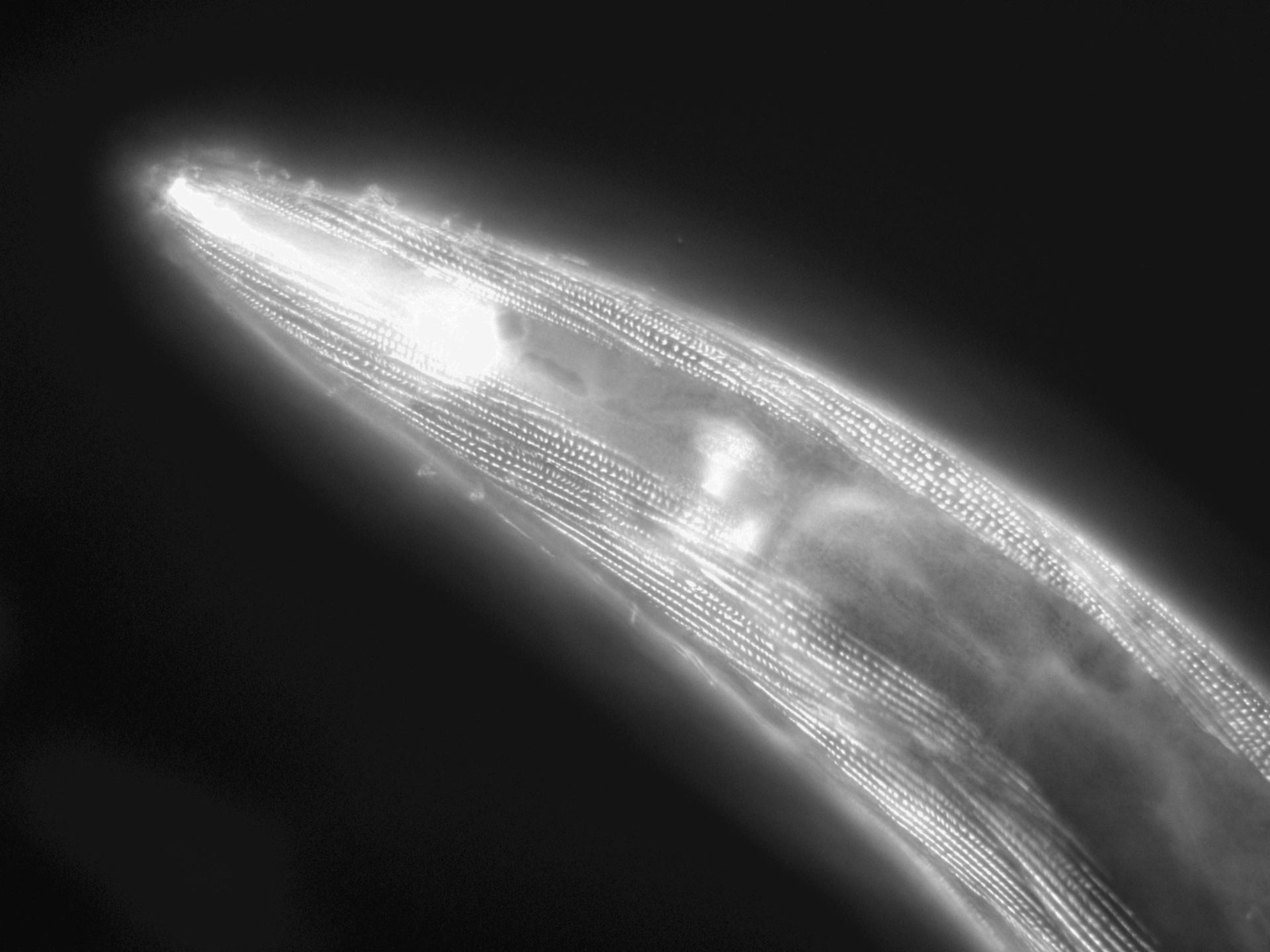 Caenorhabditis elegans (Actin filament) - CIL:1182