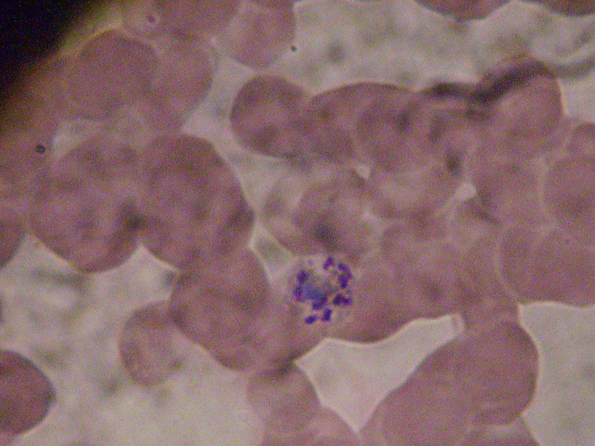plasmodium malariae schizont c.