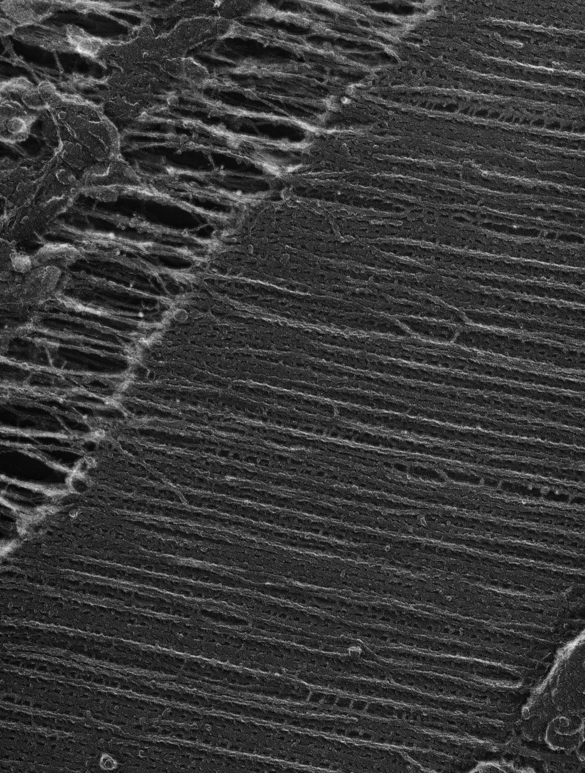 Damselfly (Sarcoplasmic reticulum) - CIL:36087
