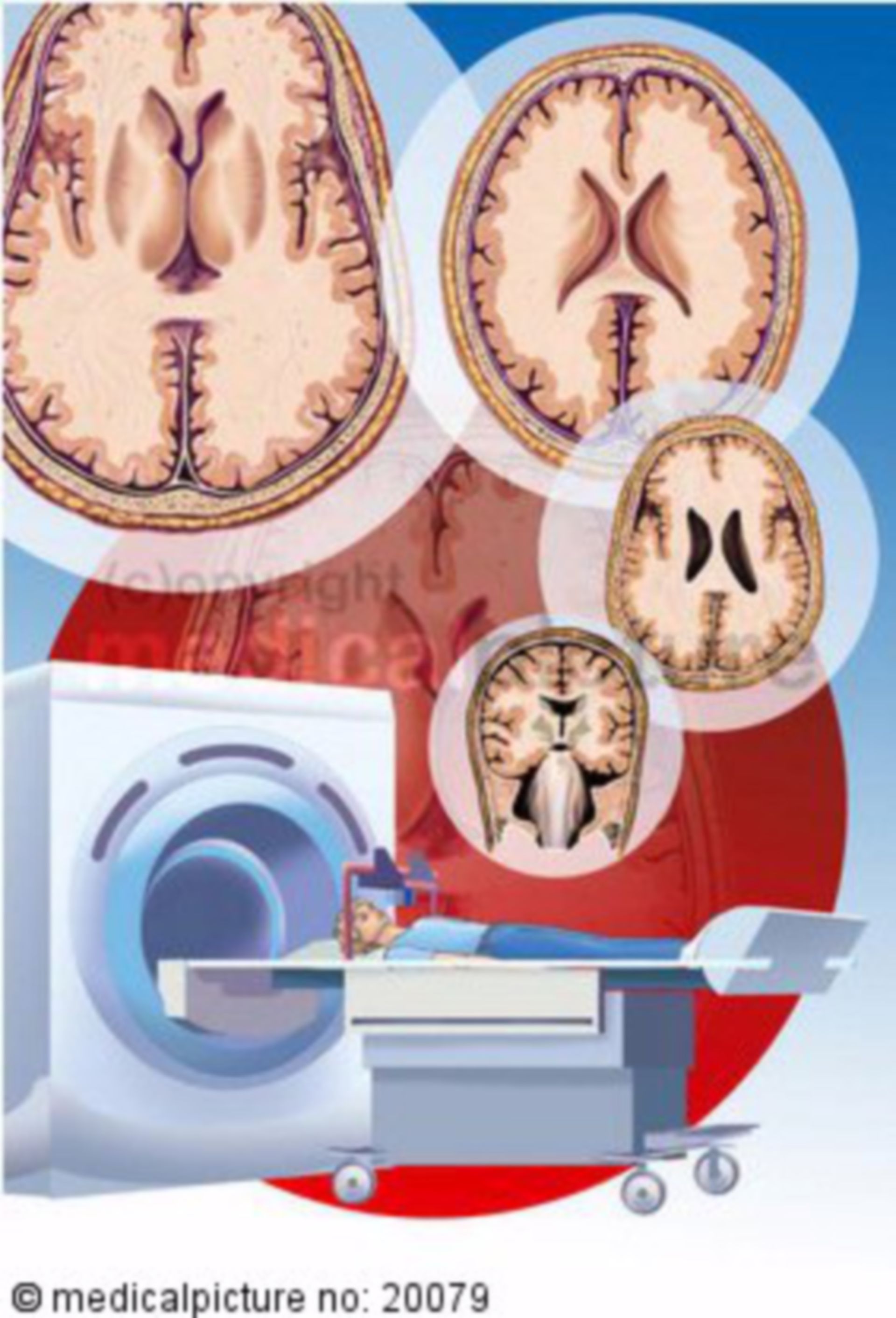  Funktionelle Computertomografie Gehirn 
