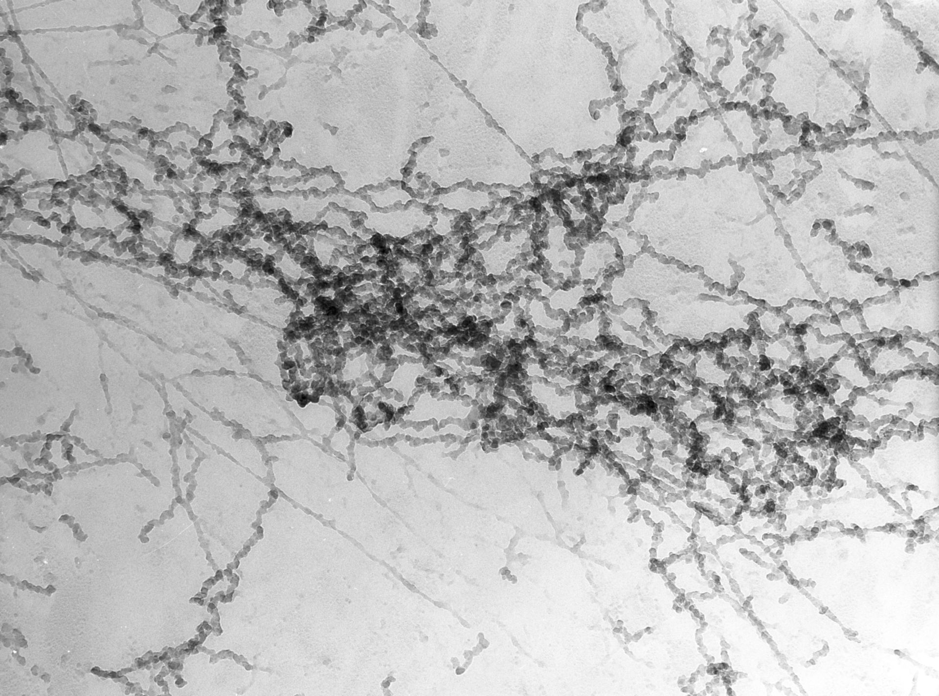 Notopthalmus viridescence (Nuclear chromatin) - CIL:10081