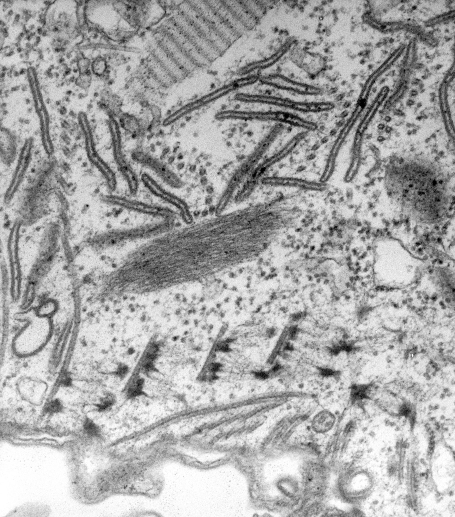 Paramecium caudatum (Oral apparatus) - CIL:39174