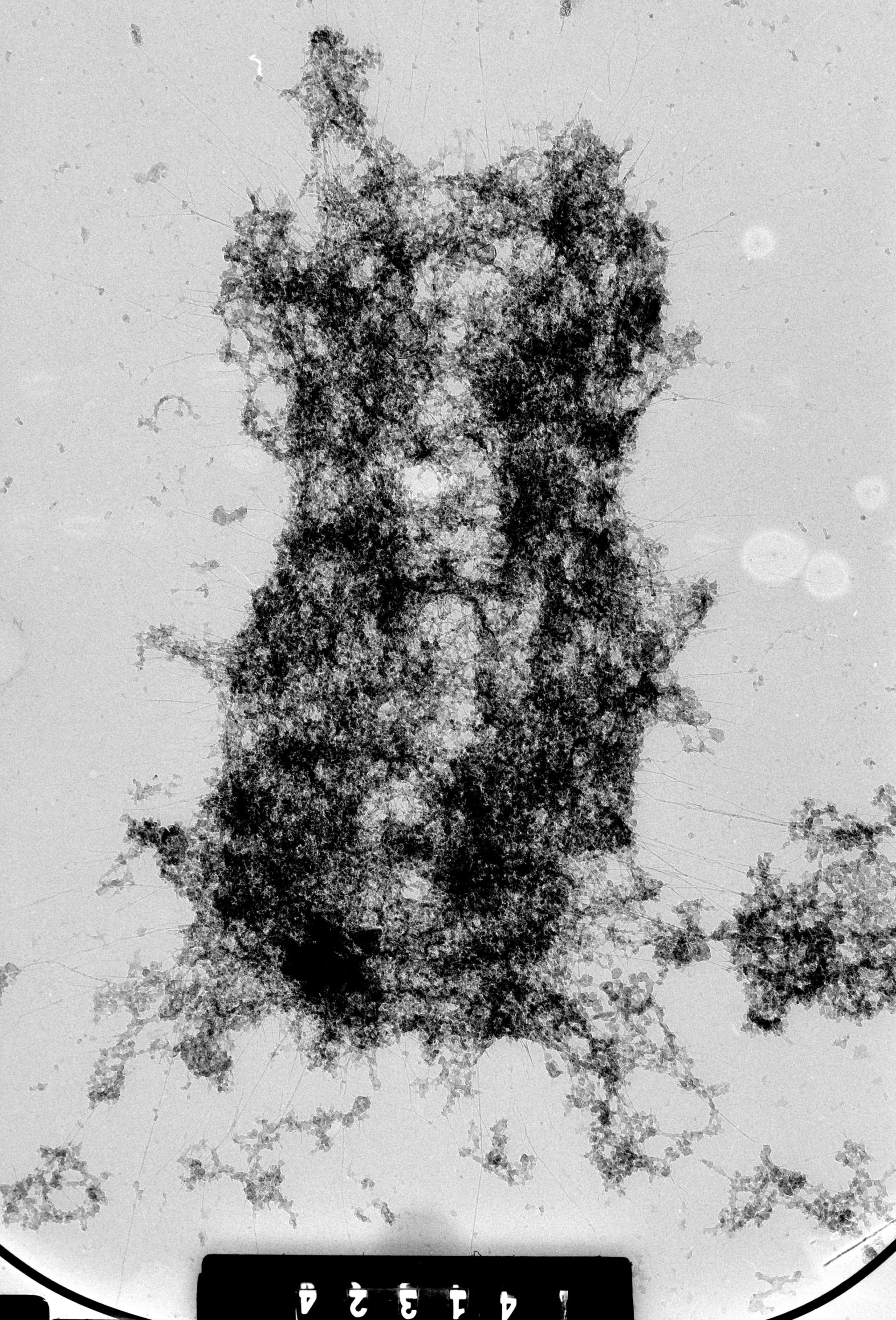 Homo sapiens (Condensed chromosome) - CIL:35375