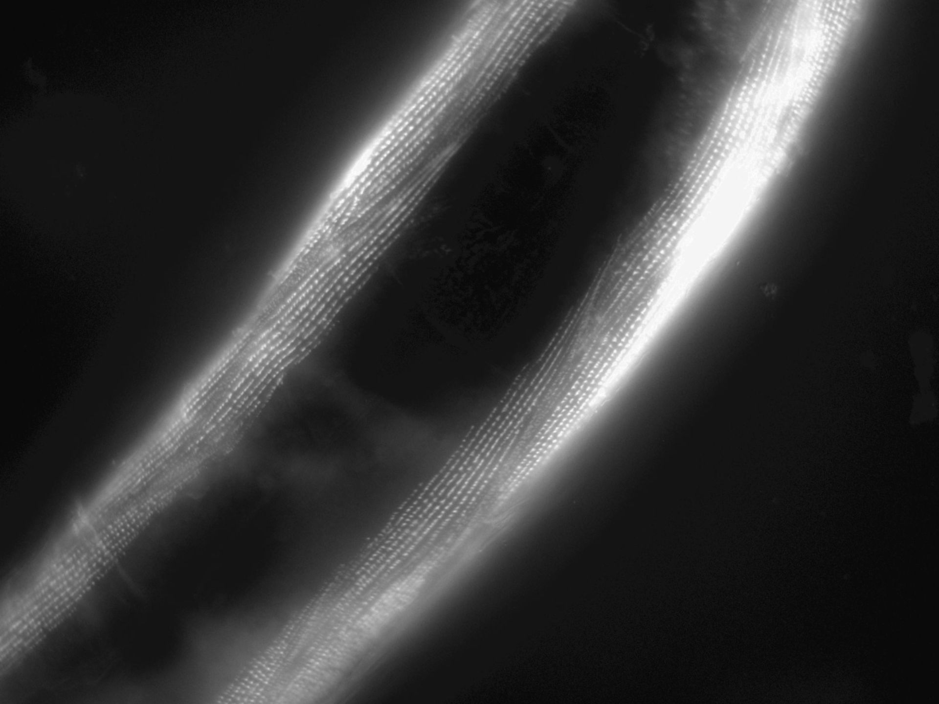 Caenorhabditis elegans (Actin filament) - CIL:1183