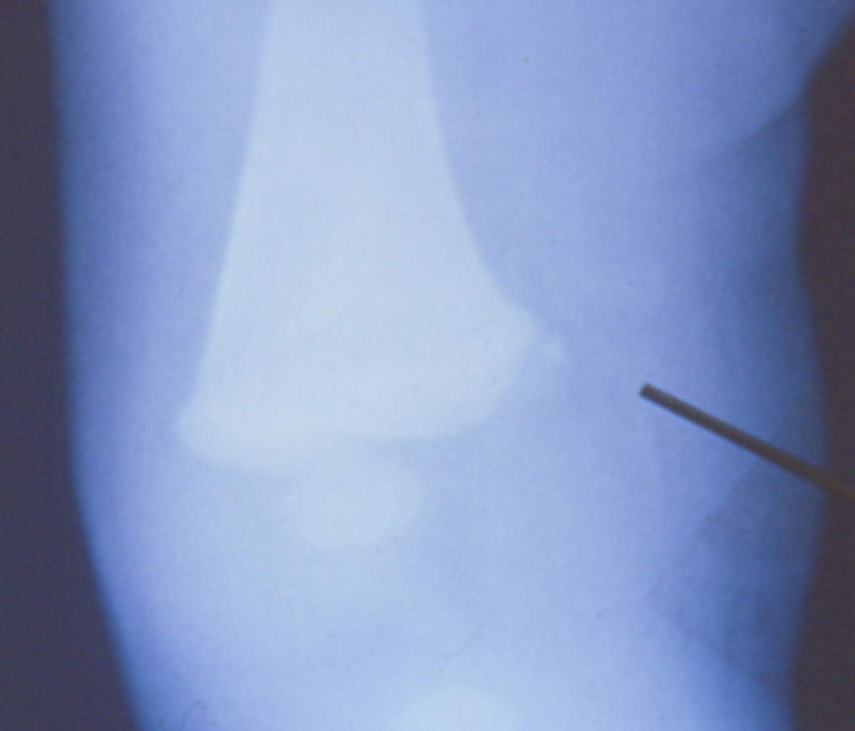 Corner sign DocCheck