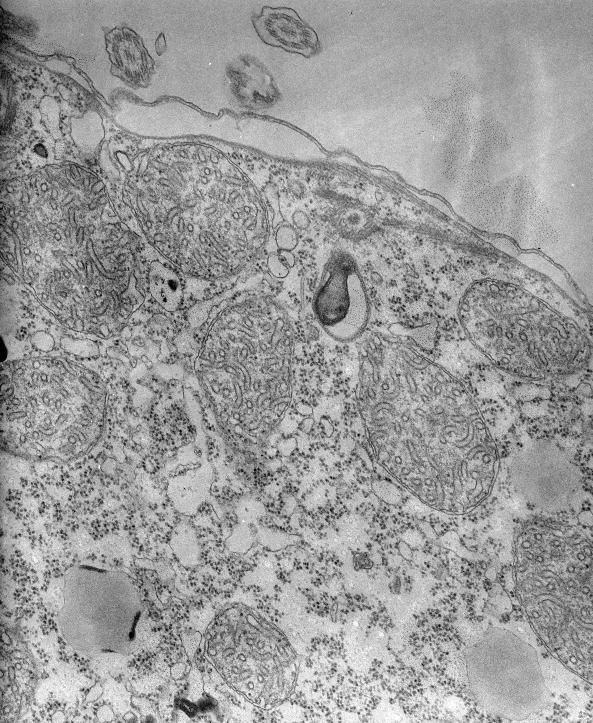 Tetrahymena pyriformis (Organelle membrane) - CIL:39722