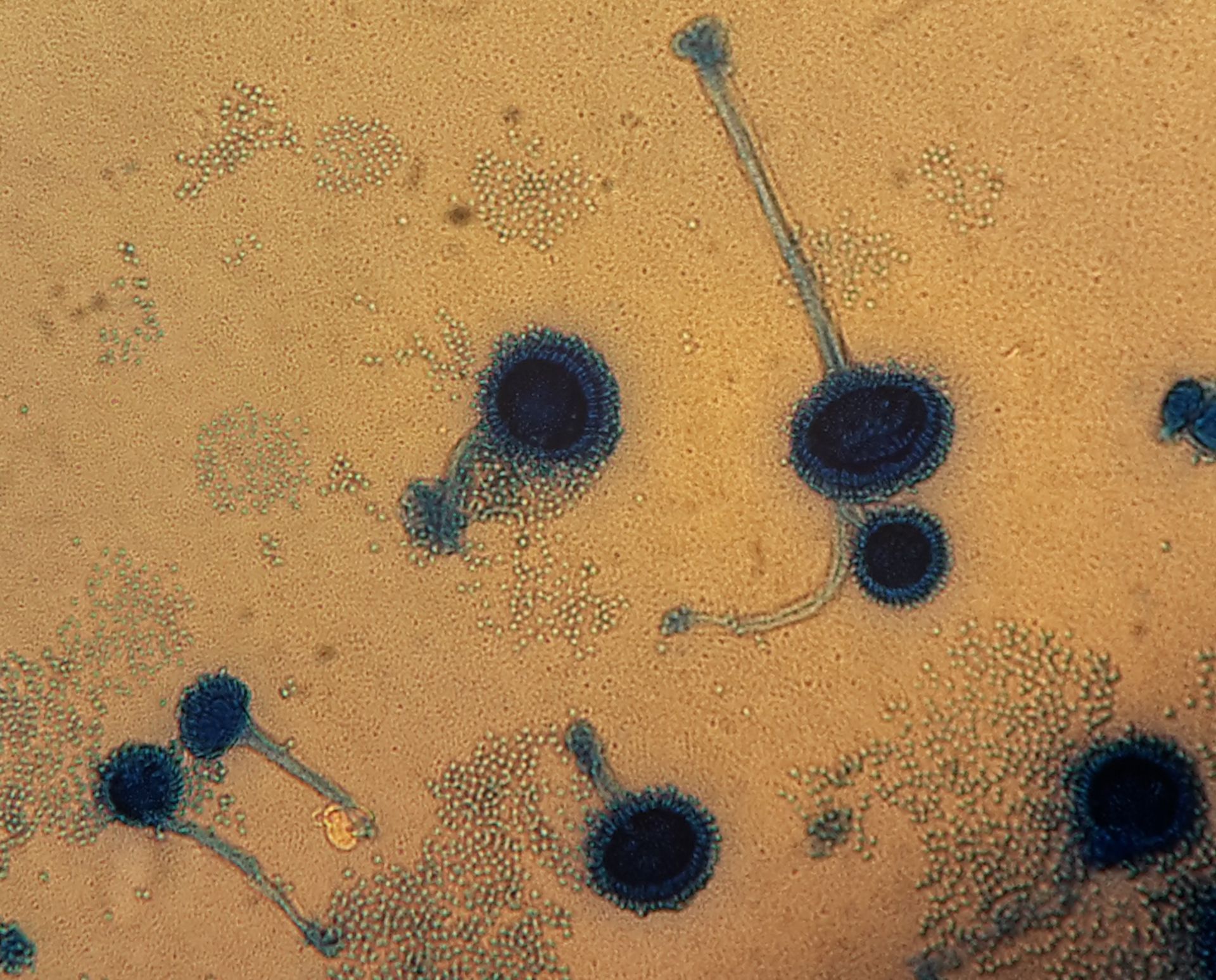 Aspergillus fumigatus Mikroskopie