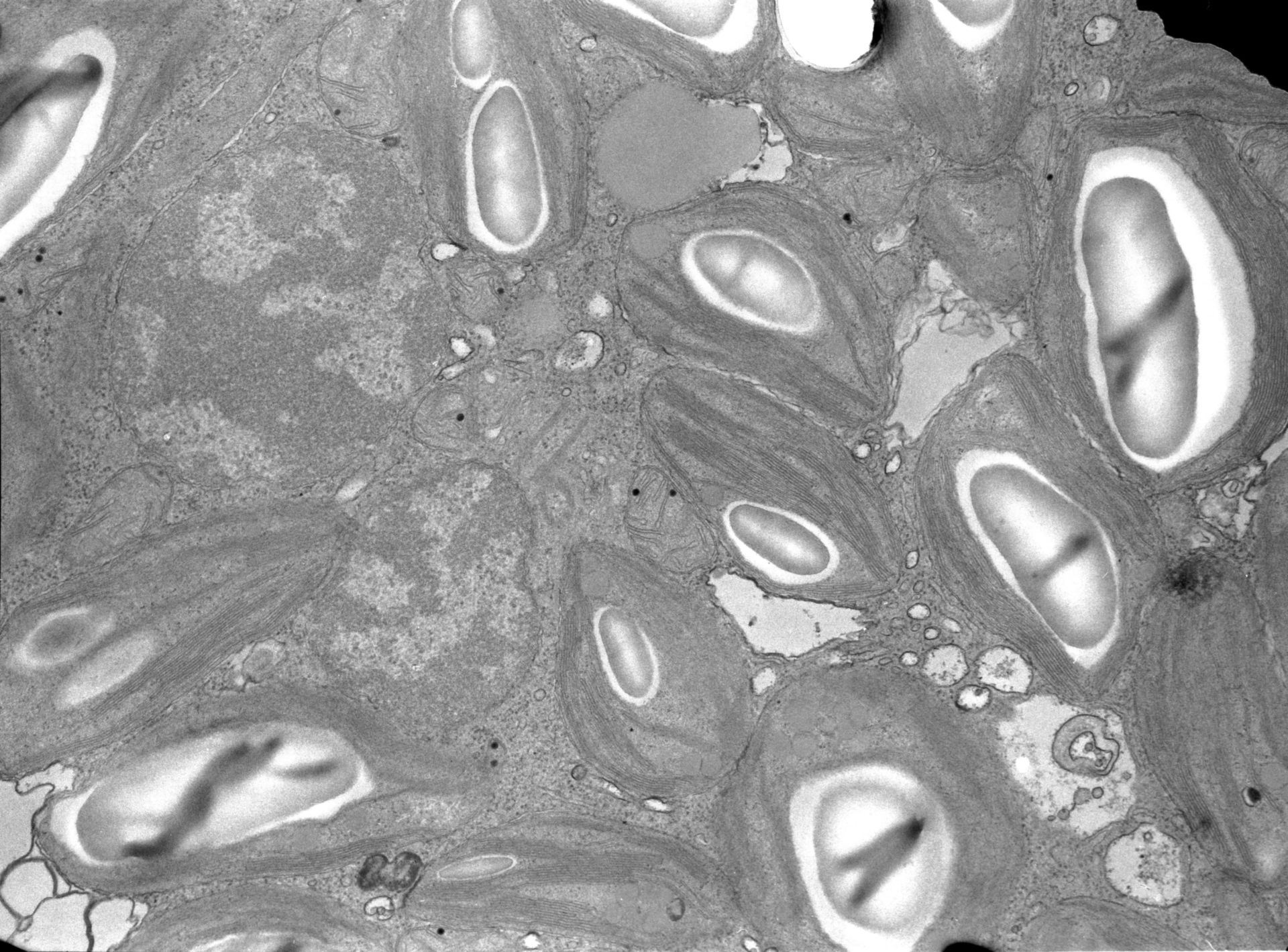 Acetabularia mediterranea (Chloroplast starch grain) - CIL:554