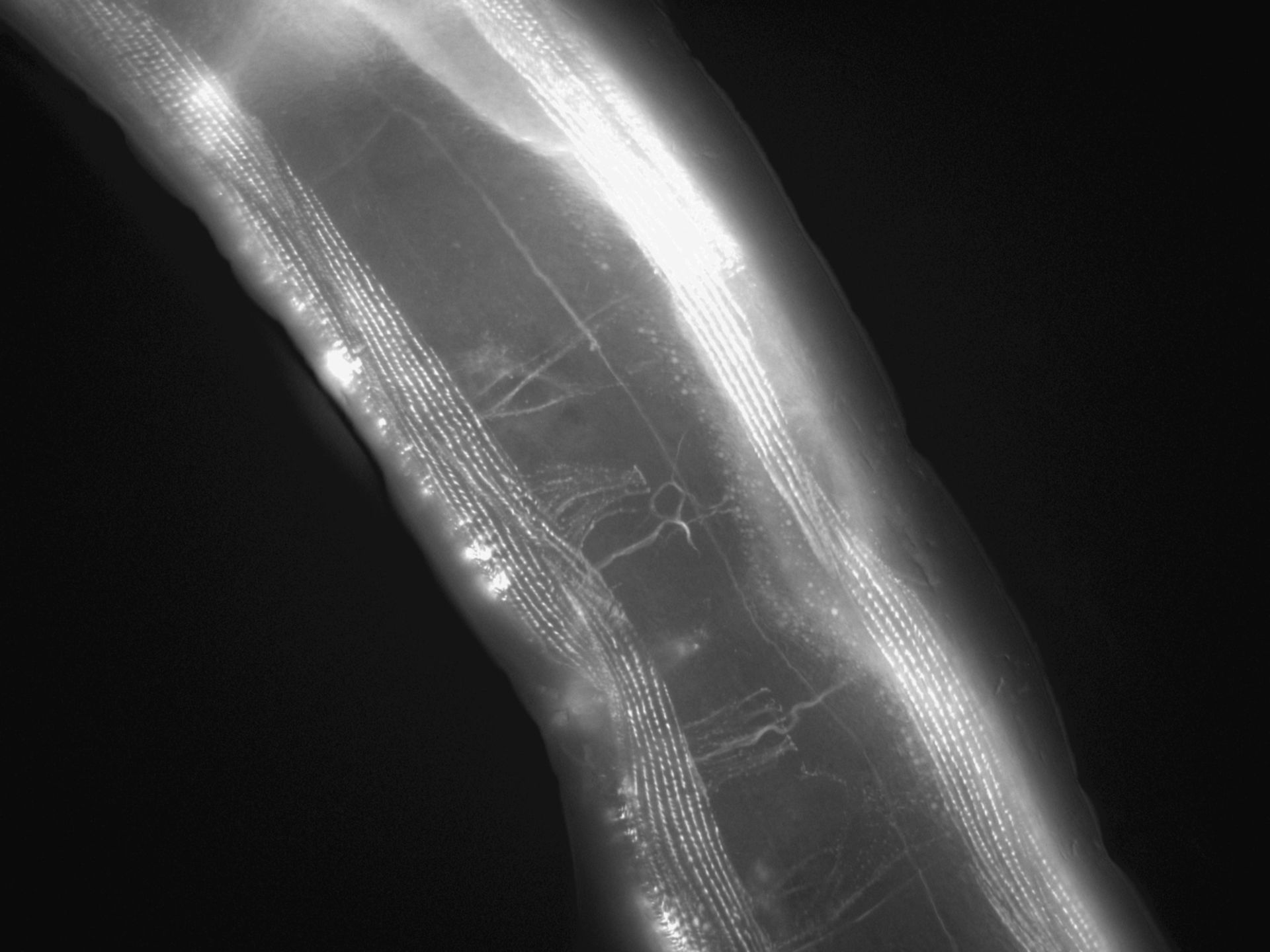 Caenorhabditis elegans (Actin filament) - CIL:1153