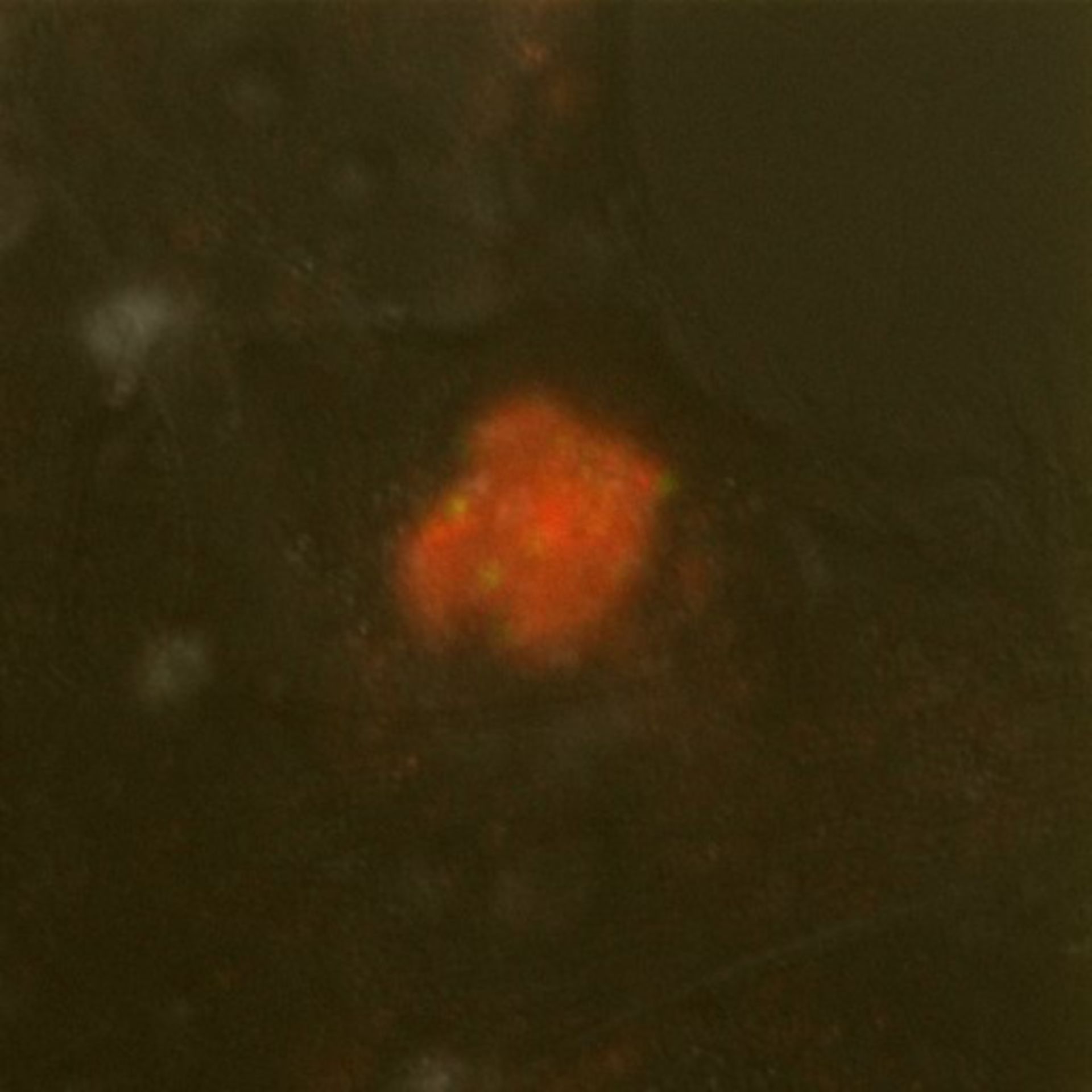 Toxoplasma gondii RH (Polar ring of apical complex) - CIL:10493