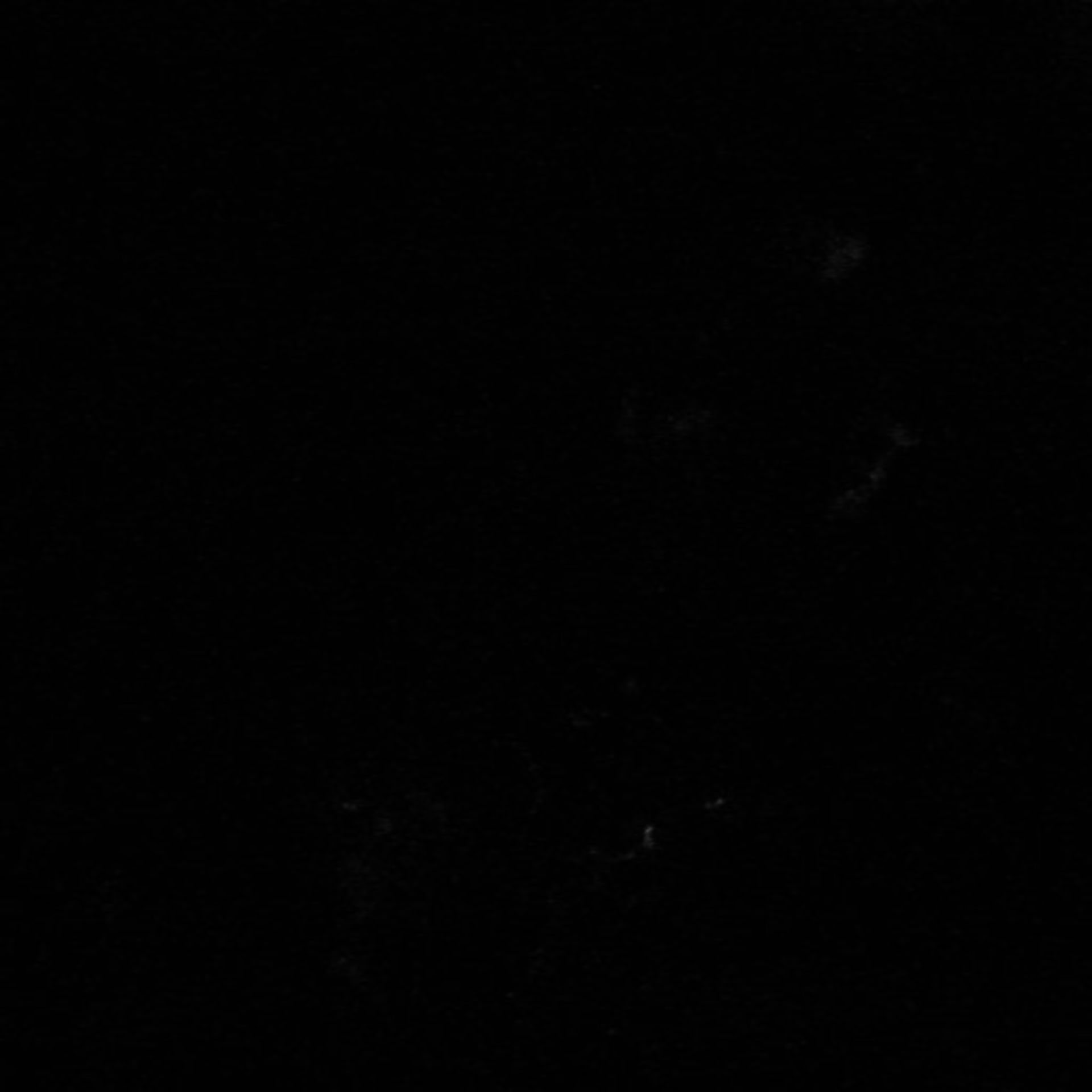 Xenopus laevis (Neuronal cell body) - CIL:37032