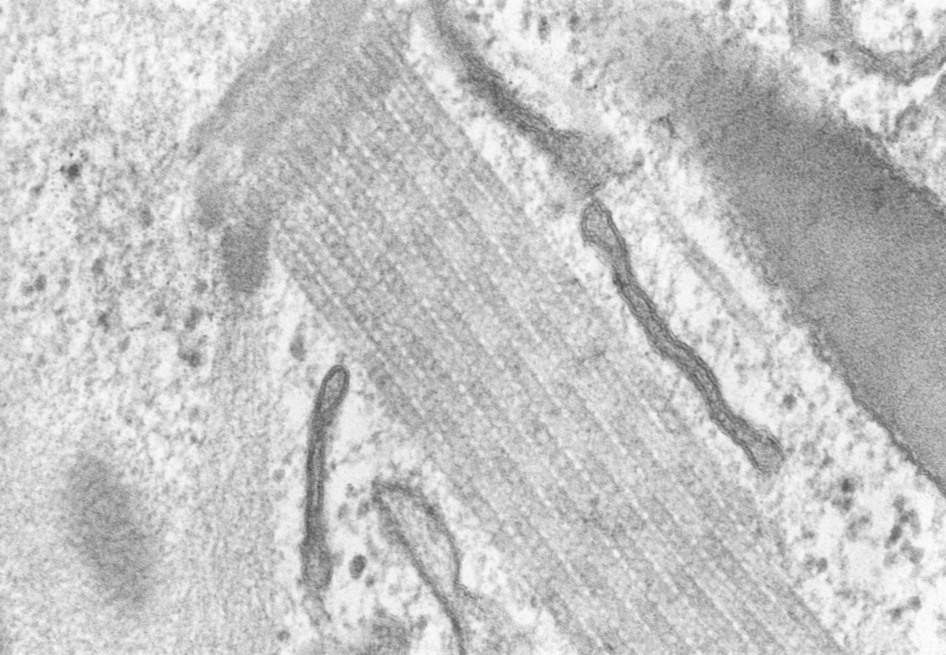 Coleps hirtus (Microtubular crossbridging) - CIL:2882