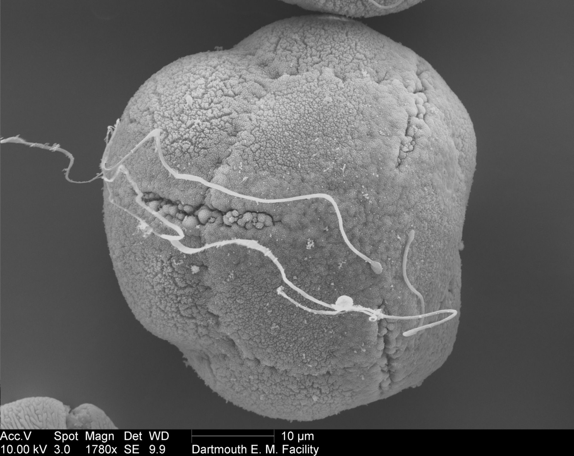 Rhododendron (Pollen wall) - CIL:40357