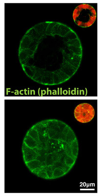 Ohne Gerüst kein Zusammenhalt: Schaltet man das Protein Formin-like 2 aus, so bilden die betroffenen Epithelzellen (unten) keine Hohlräume, anders als unbehandelte Zellen (oben). © Autoren