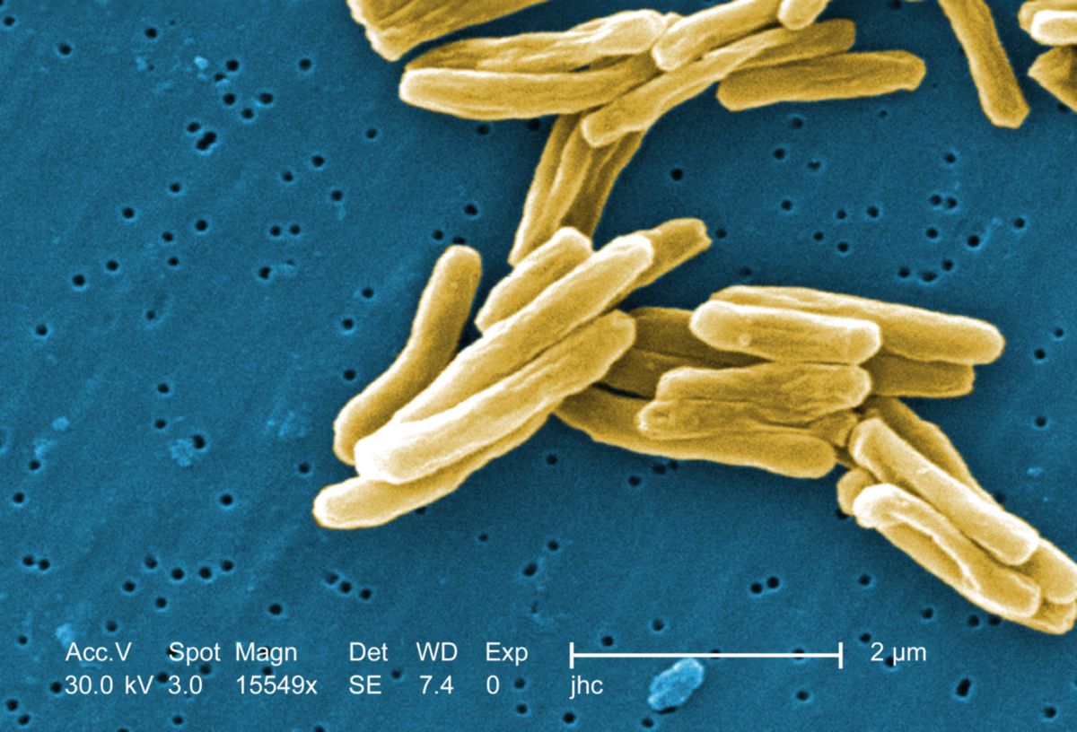 Mycobacterium tuberculosis (Rasterelektronenmikroskop)
