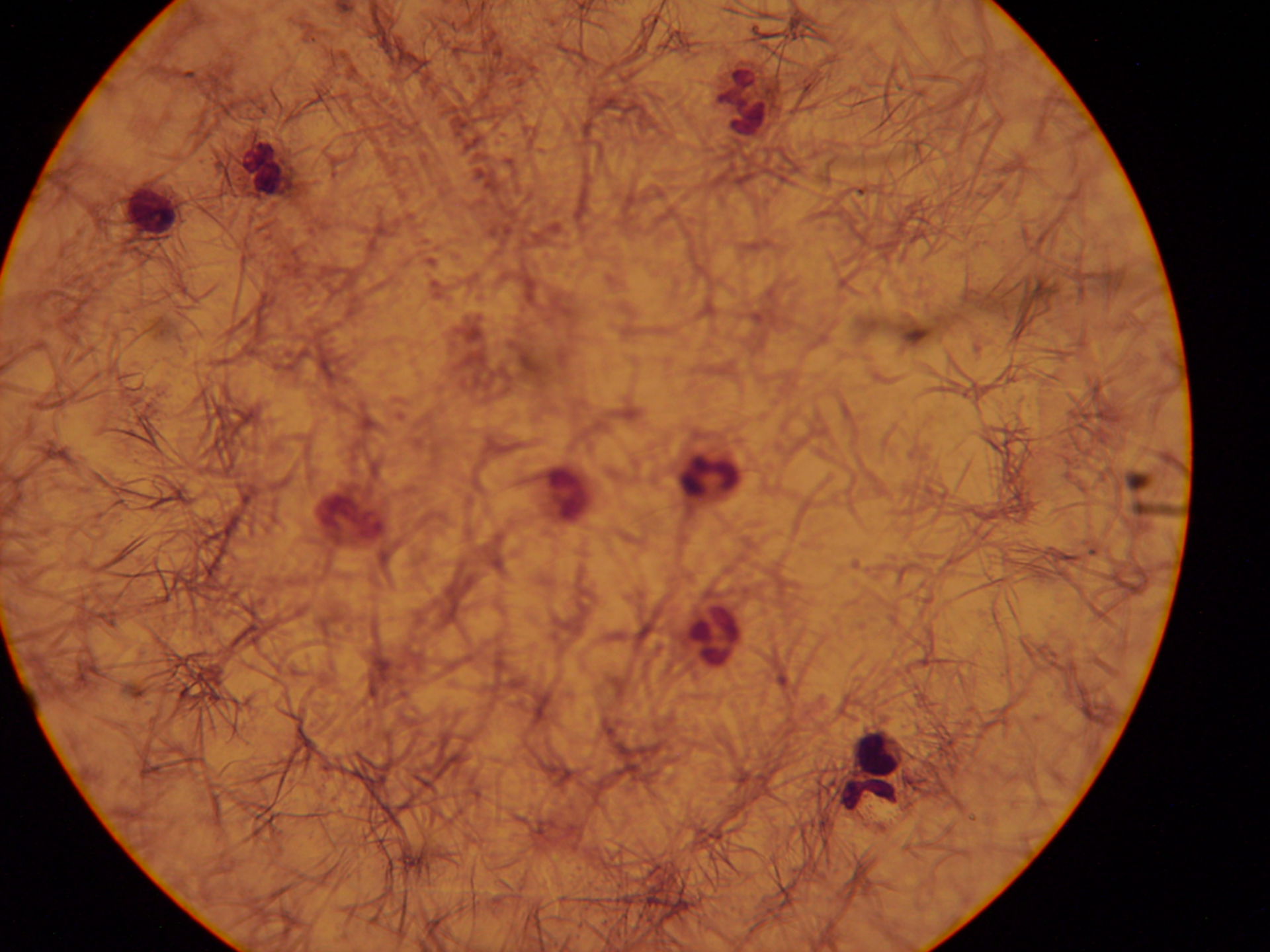 Plasmodium ovale: Schüffeler Tüpfelung