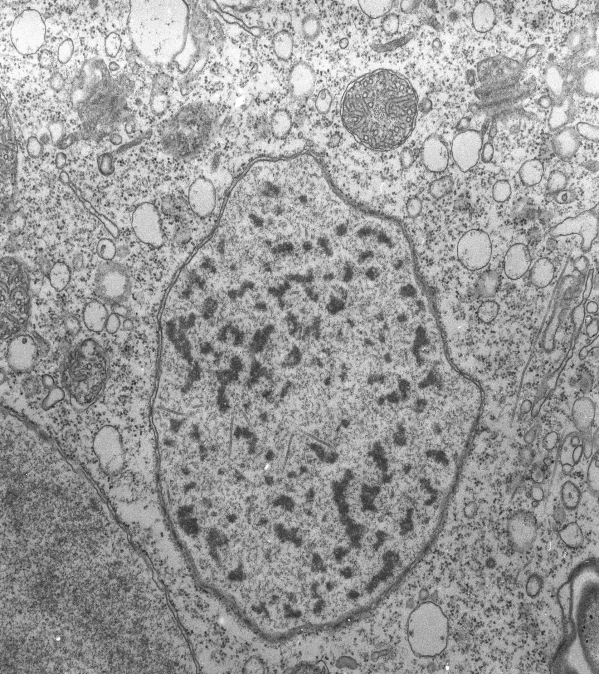 Vorticella convallaria (Heterochromatin) - CIL:39452