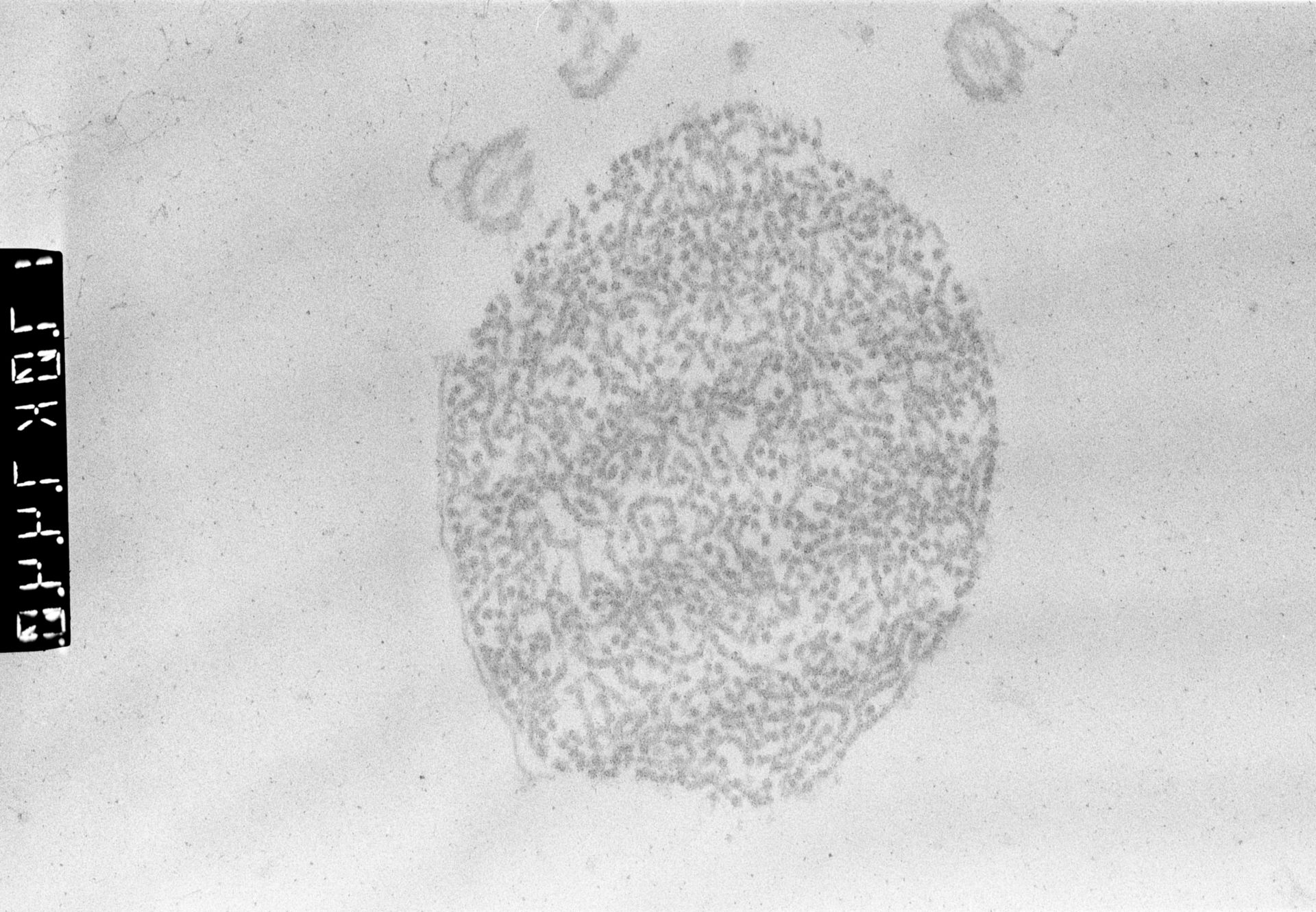 Patiria miniata (Male germ cell nucleus) - CIL:503