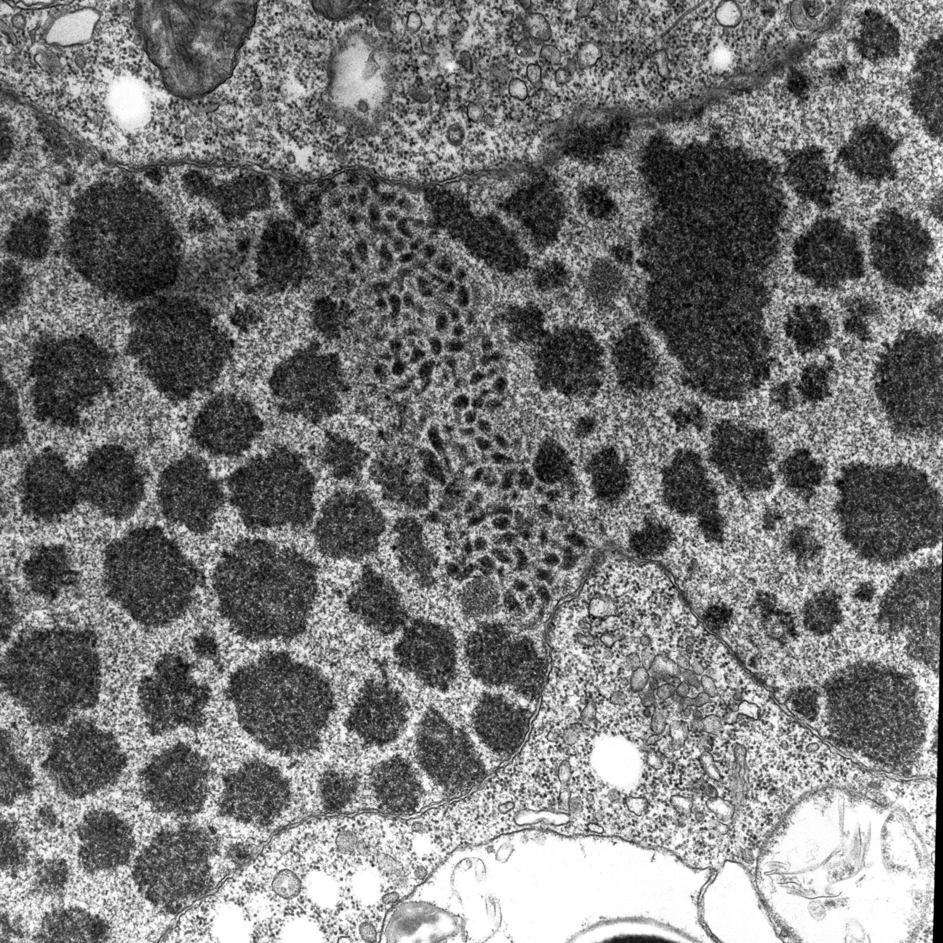 Halteria grandinella (Nucleolus) - CIL:7601