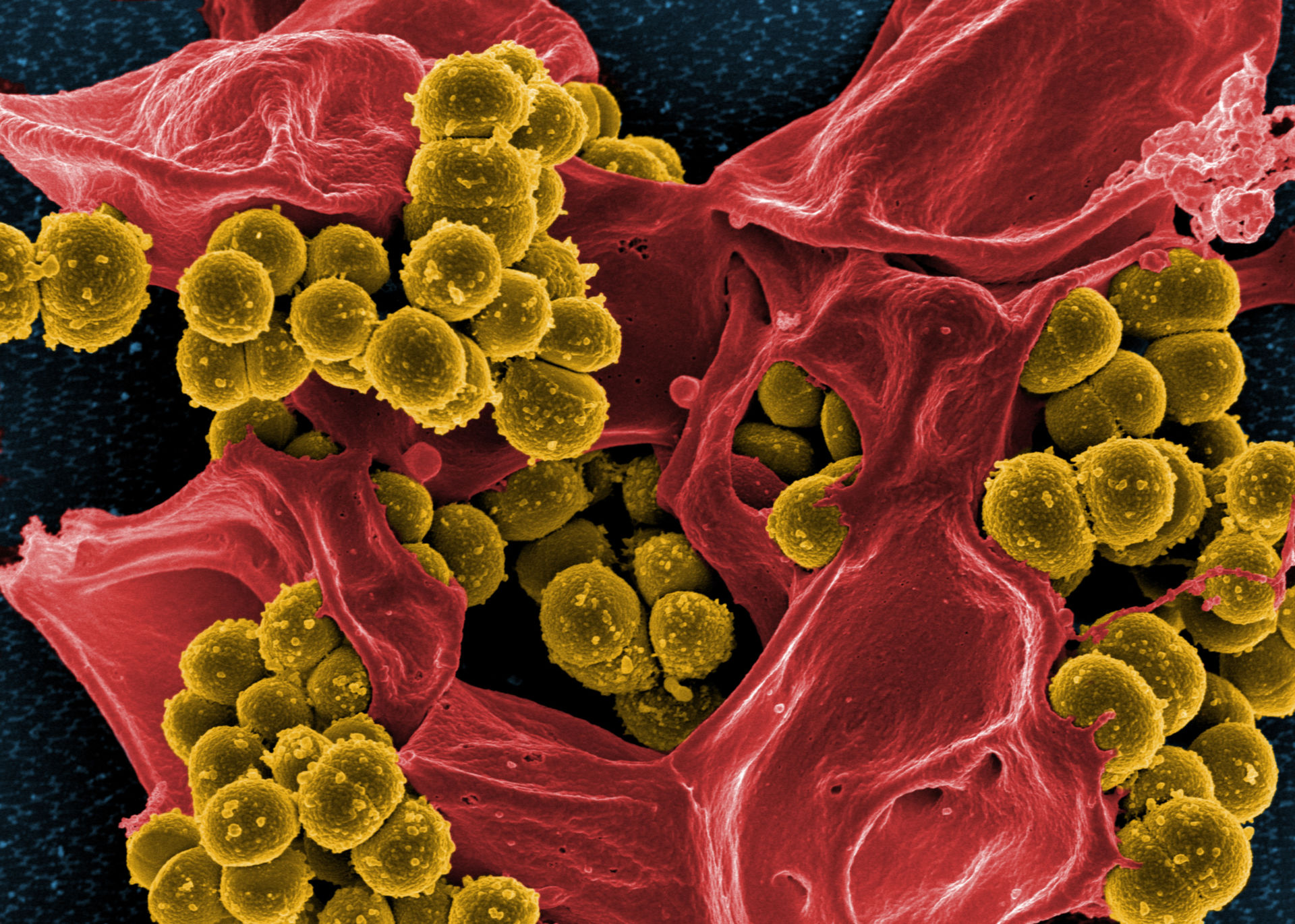Micrografia di Staphylococcus aureus meticillino-resistente (MRSA)