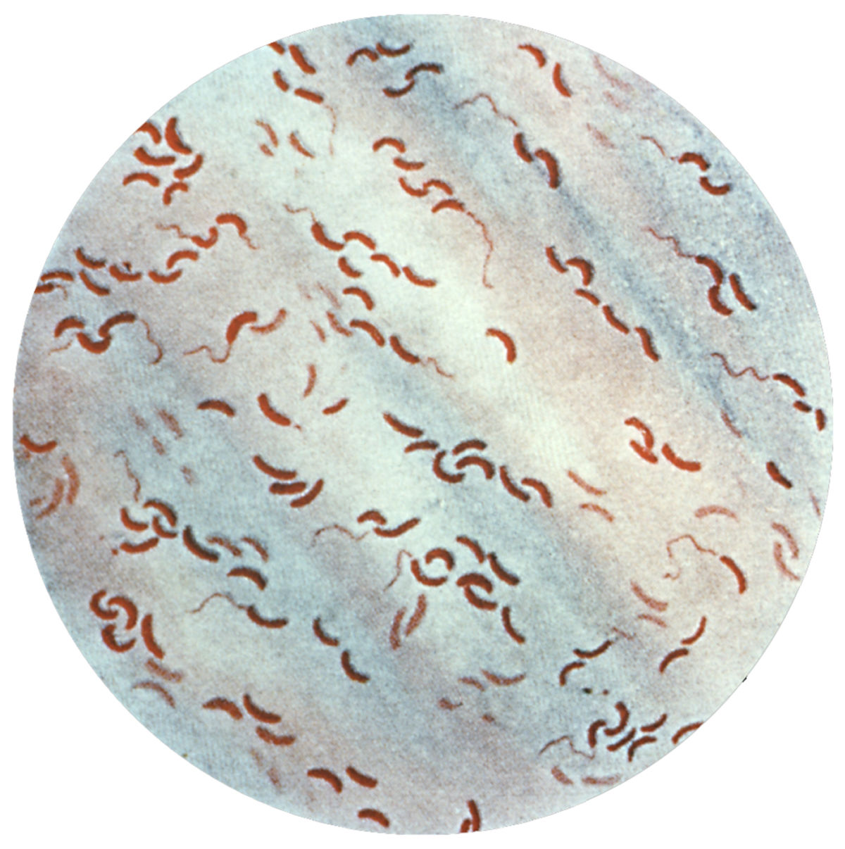 Vibrio comma