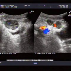 Mesenterium - DocCheck Flexikon