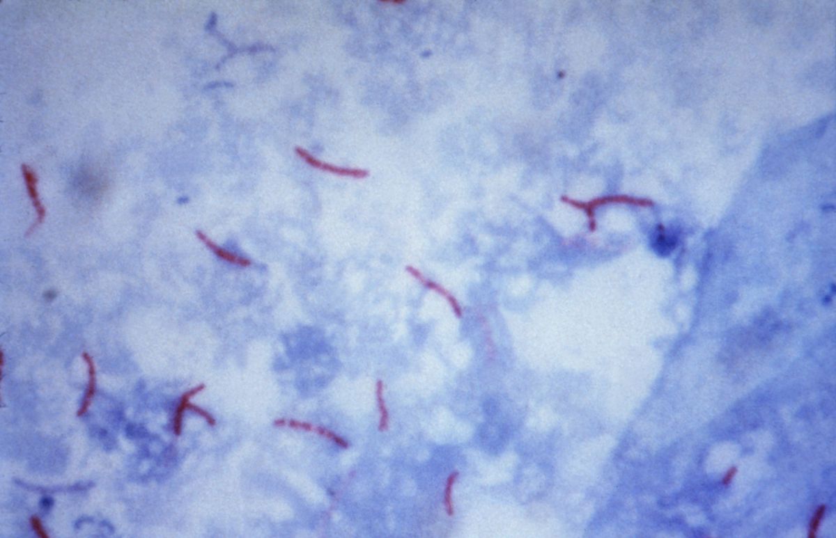 Mycobacterium tuberculosis (Histologie)