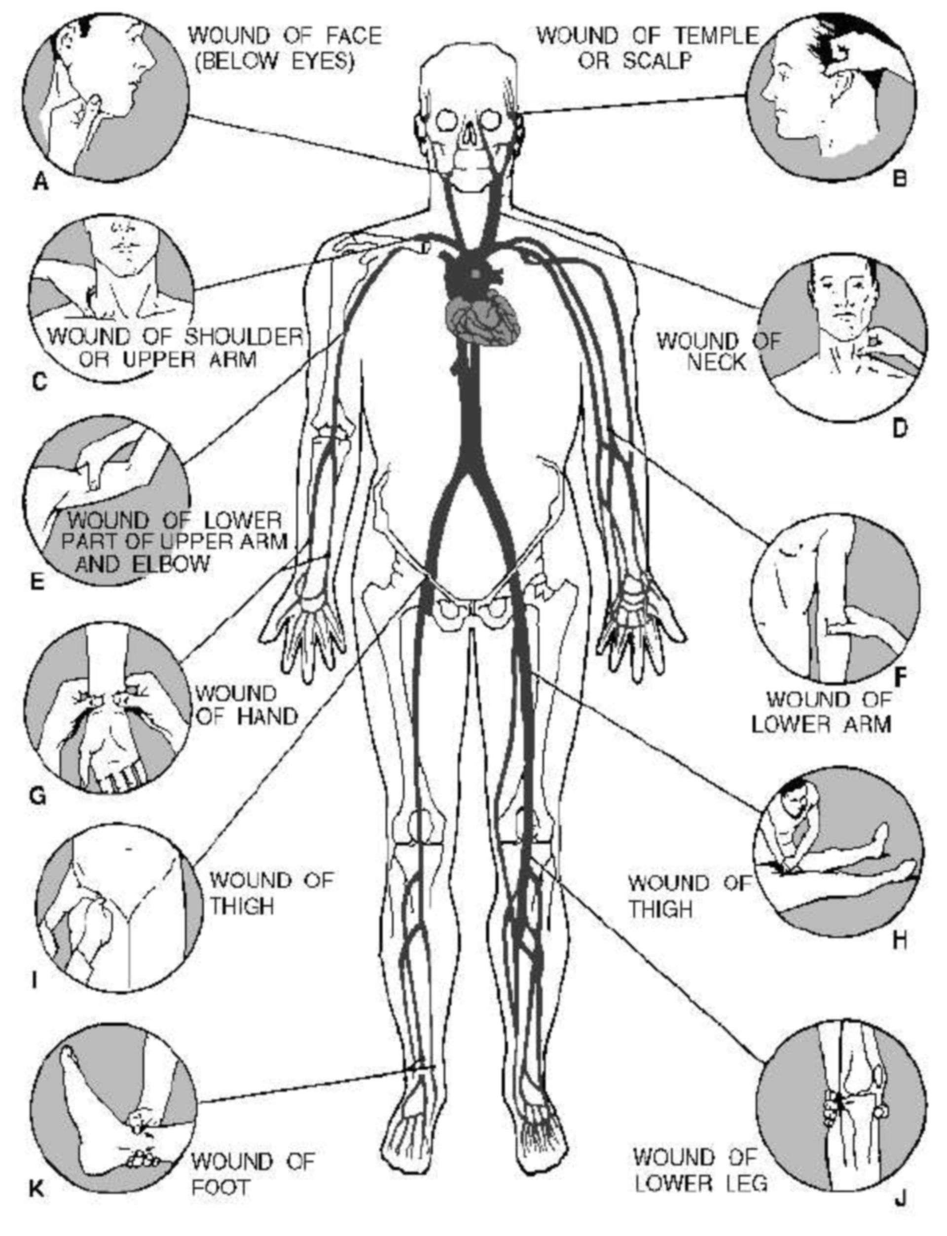 Diagram showing th location of the pressure points that can be used to control bleeding.