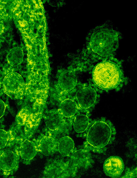 Transmissionselektronenmikroskopische Aufnahme (TEM) von MERS-CoV-Viruspartikeln außerhalb der Zelle (Virionen). © National Institute of Allergy and Infectious Diseases (NIAID)