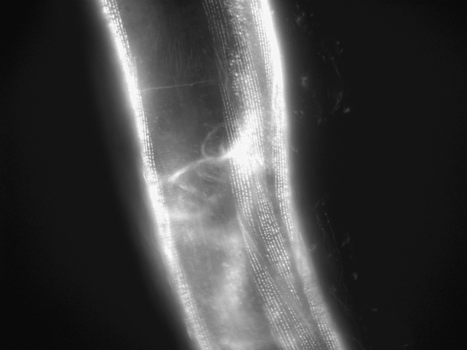 Caenorhabditis elegans (Actin filament) - CIL:1116