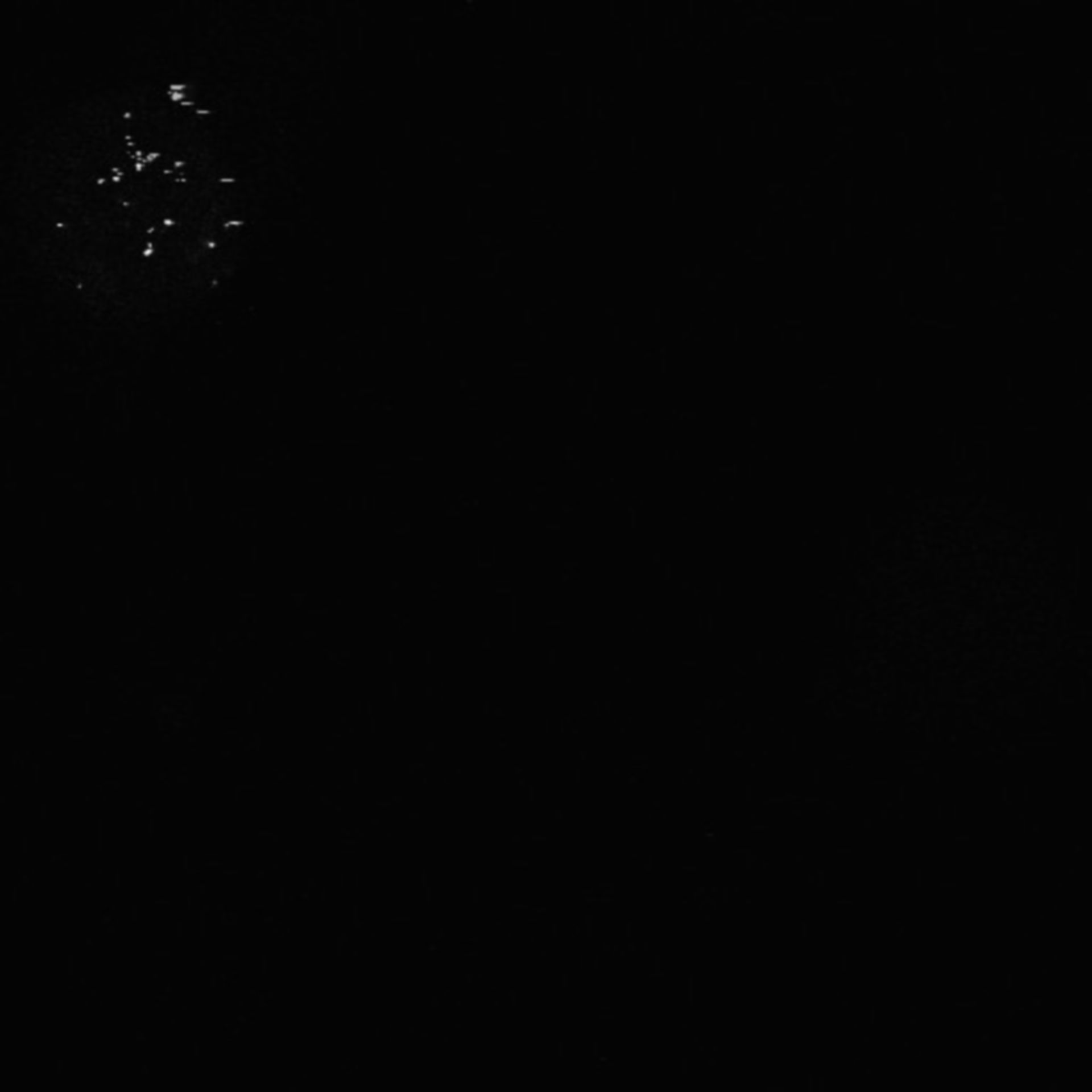 Xenopus laevis (Neuronal cell body) - CIL:36961
