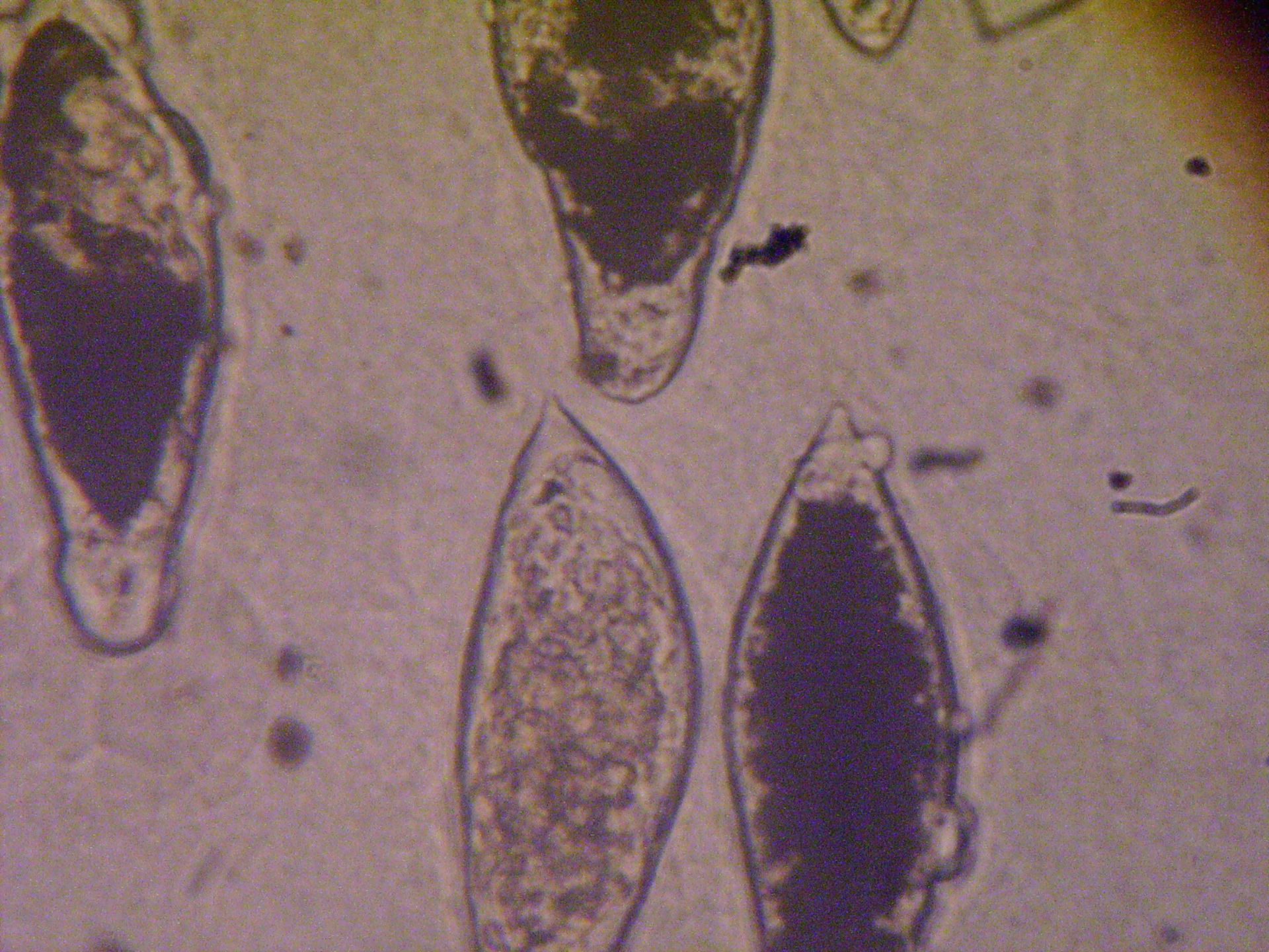 Schist haematobium a